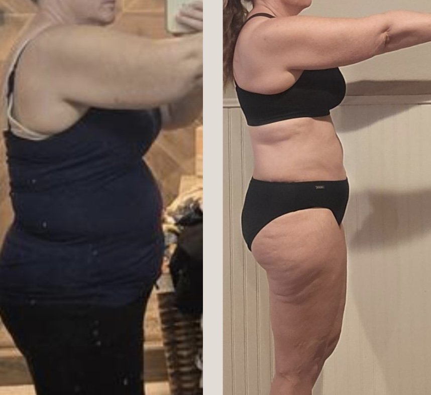 Side-by-side comparison photo showing a woman's body before and after weight loss. The left has a larger torso and arm, while the right shows a slimmer, more toned physique.