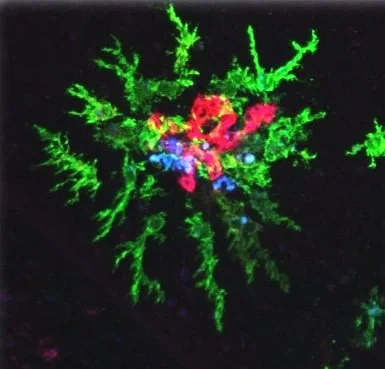 ocular neovascularization confocal image with labeled microglia