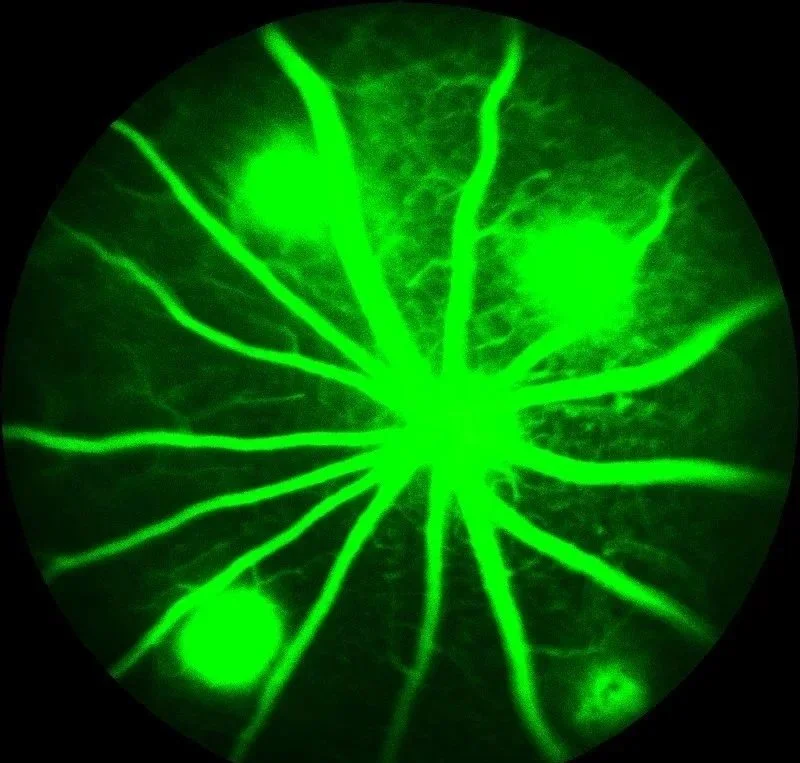 laser-induced cnv fluorescein angiography