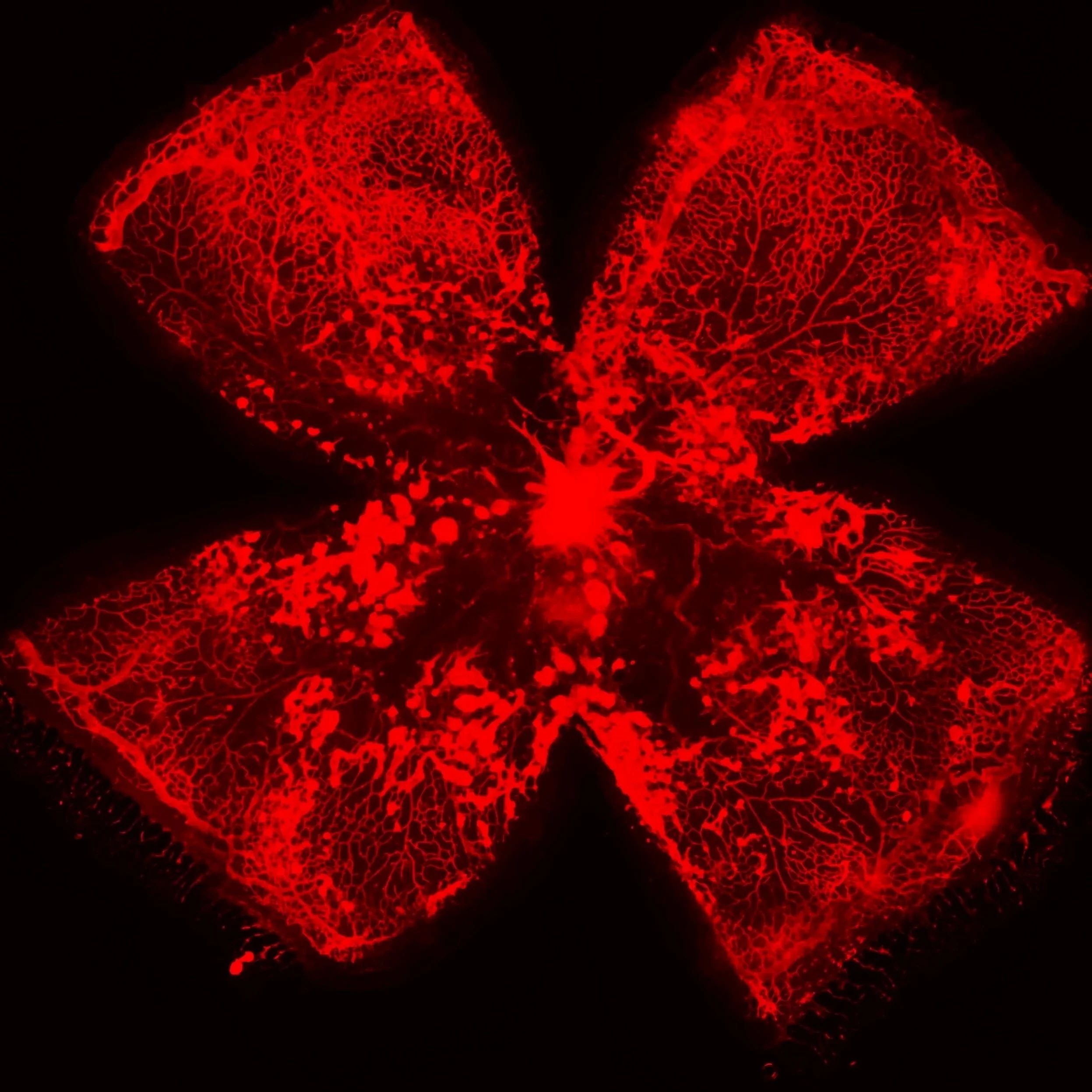 oxygen-induced retinopathy retinal flat mount