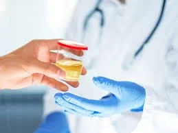 Person in medical gloves holding a small container of liquid