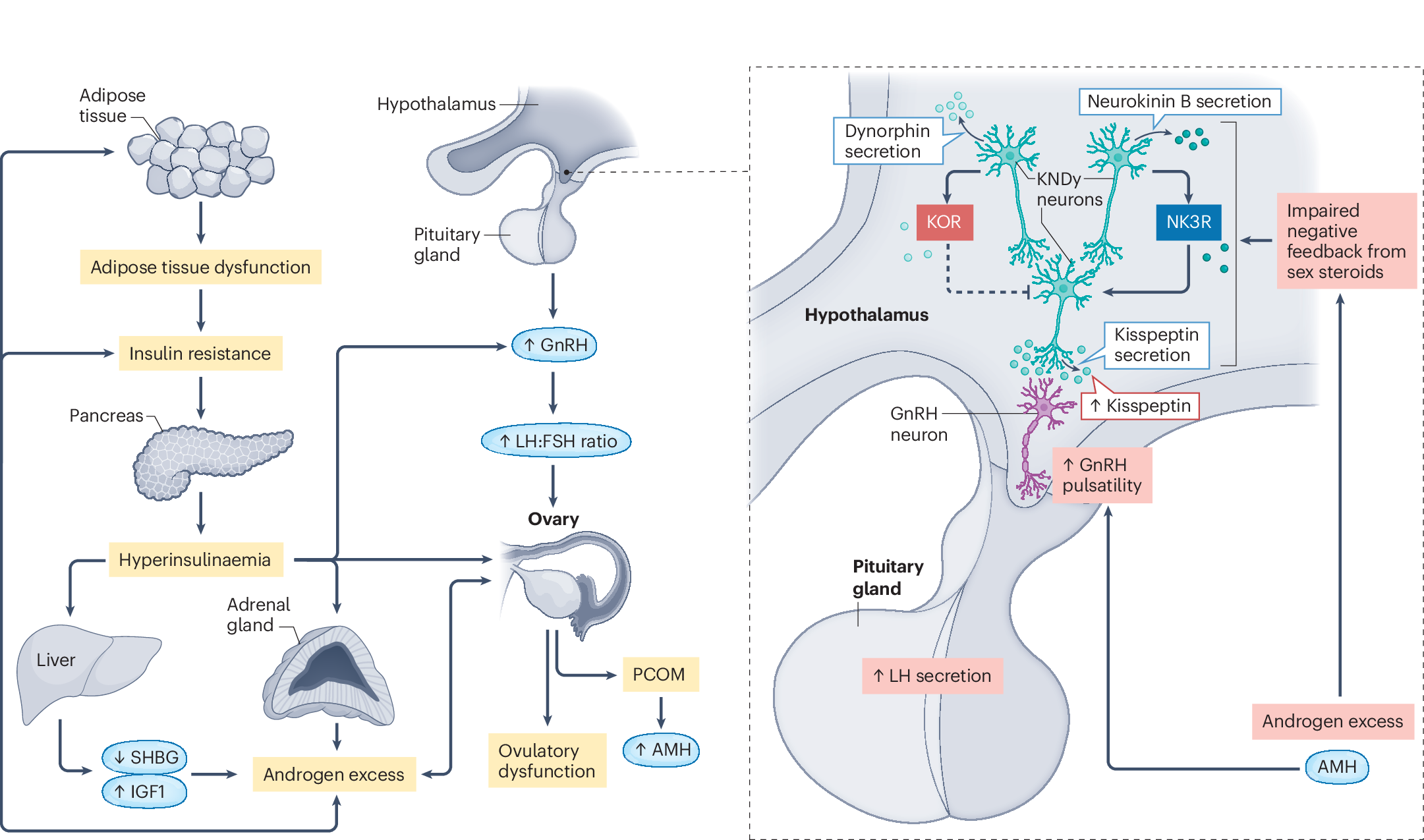 How your brain drives PMOS hormone Imbalance