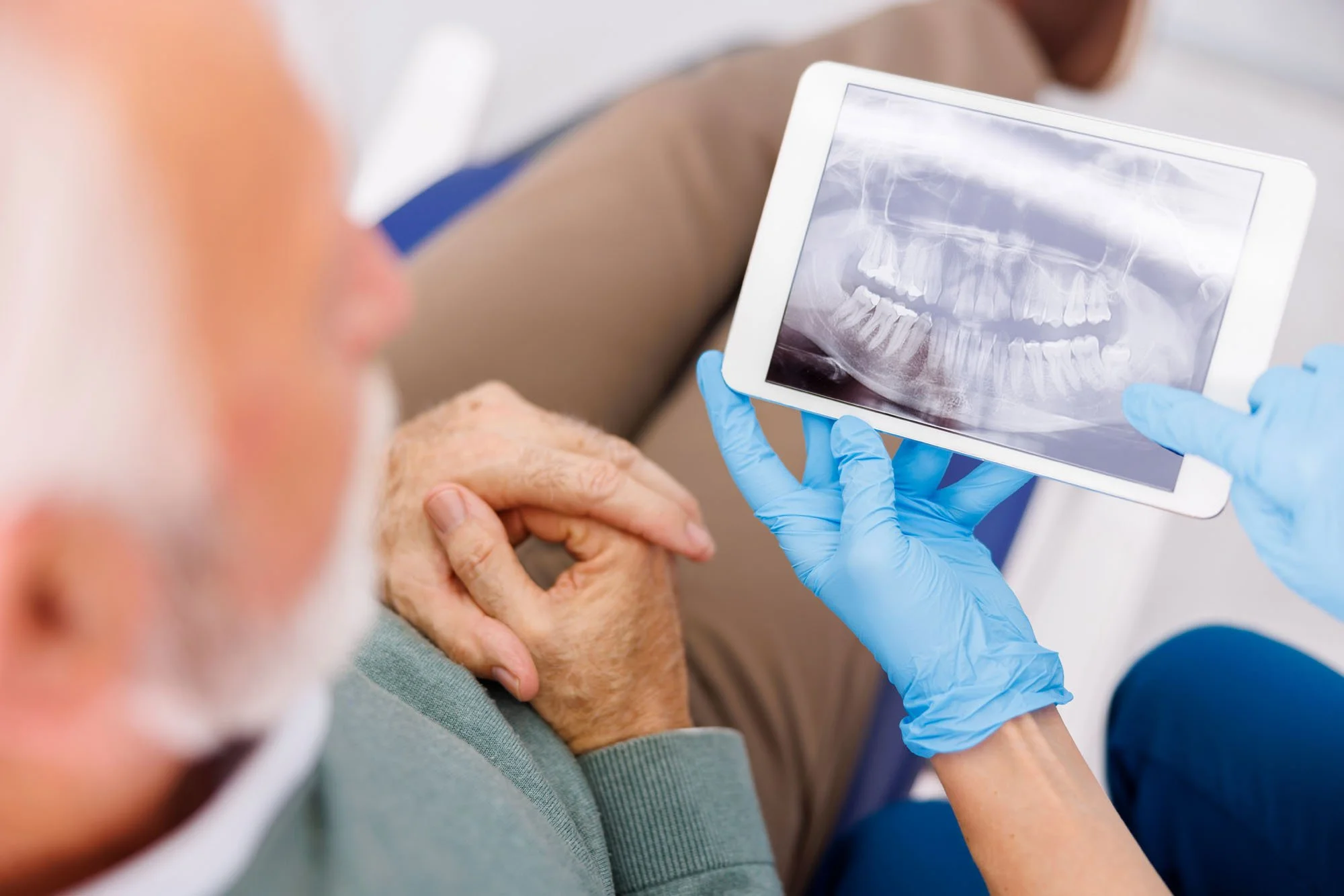 Bone Grafting Before Dental Implants