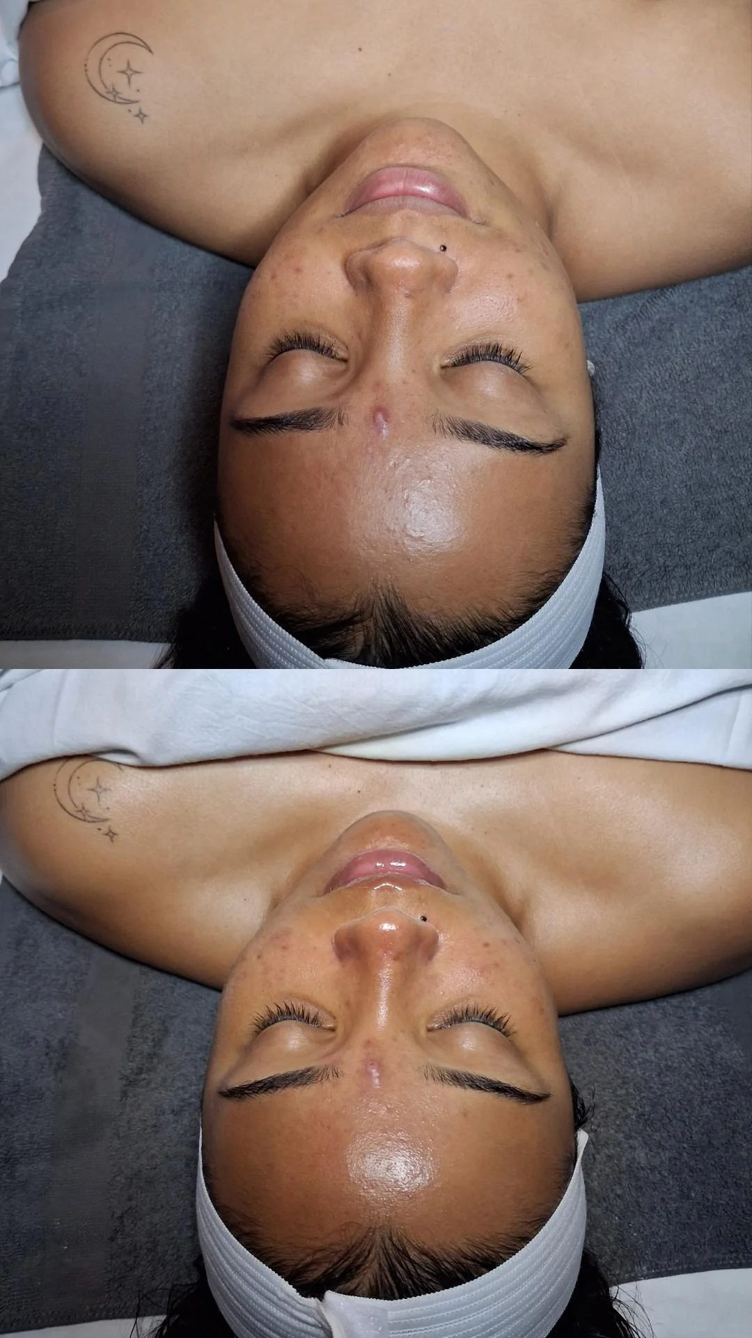 Zero Downtime Peel