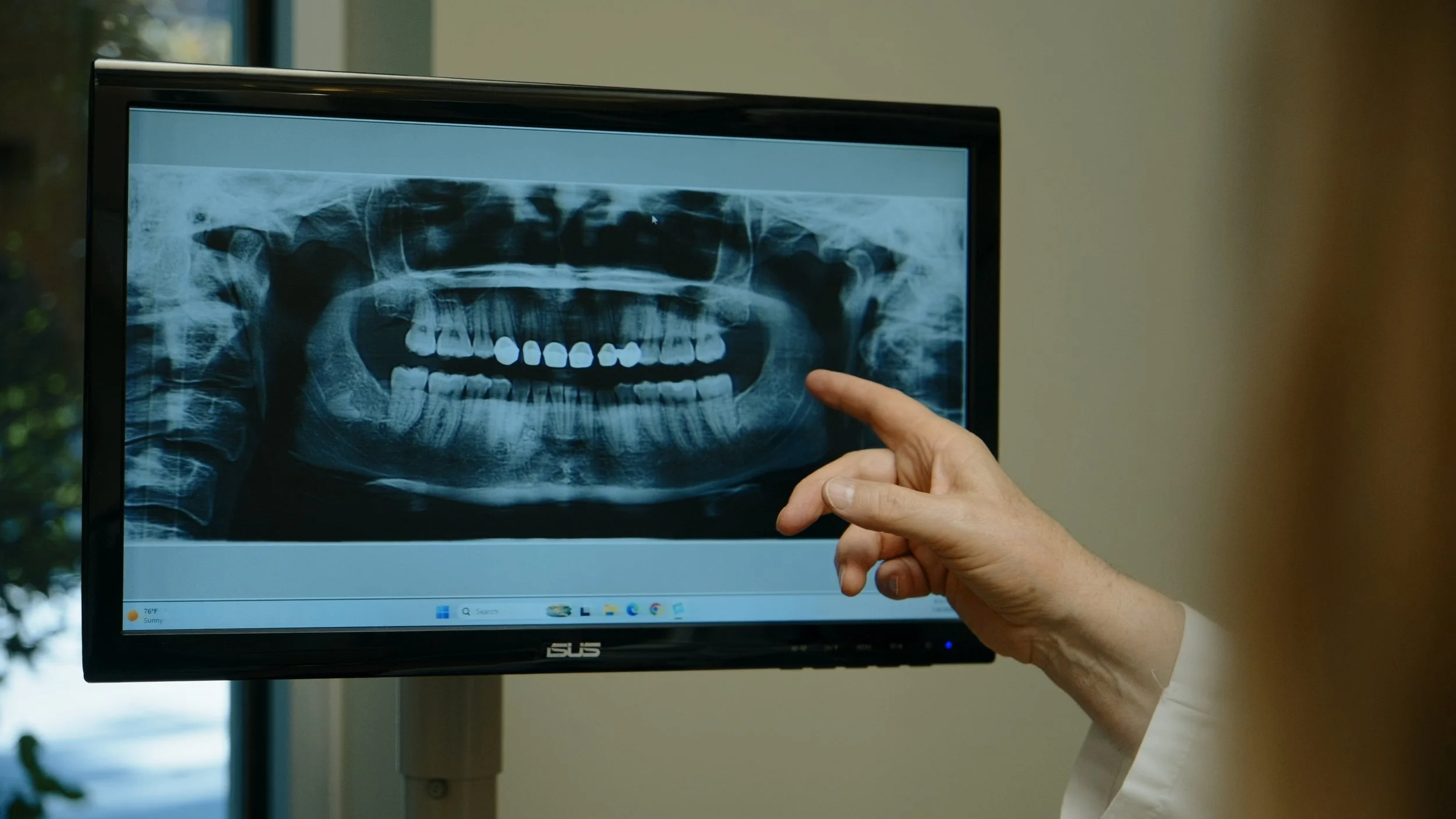 Close-up of a person's hand pointing at a dental X-ray displayed on a computer monitor.