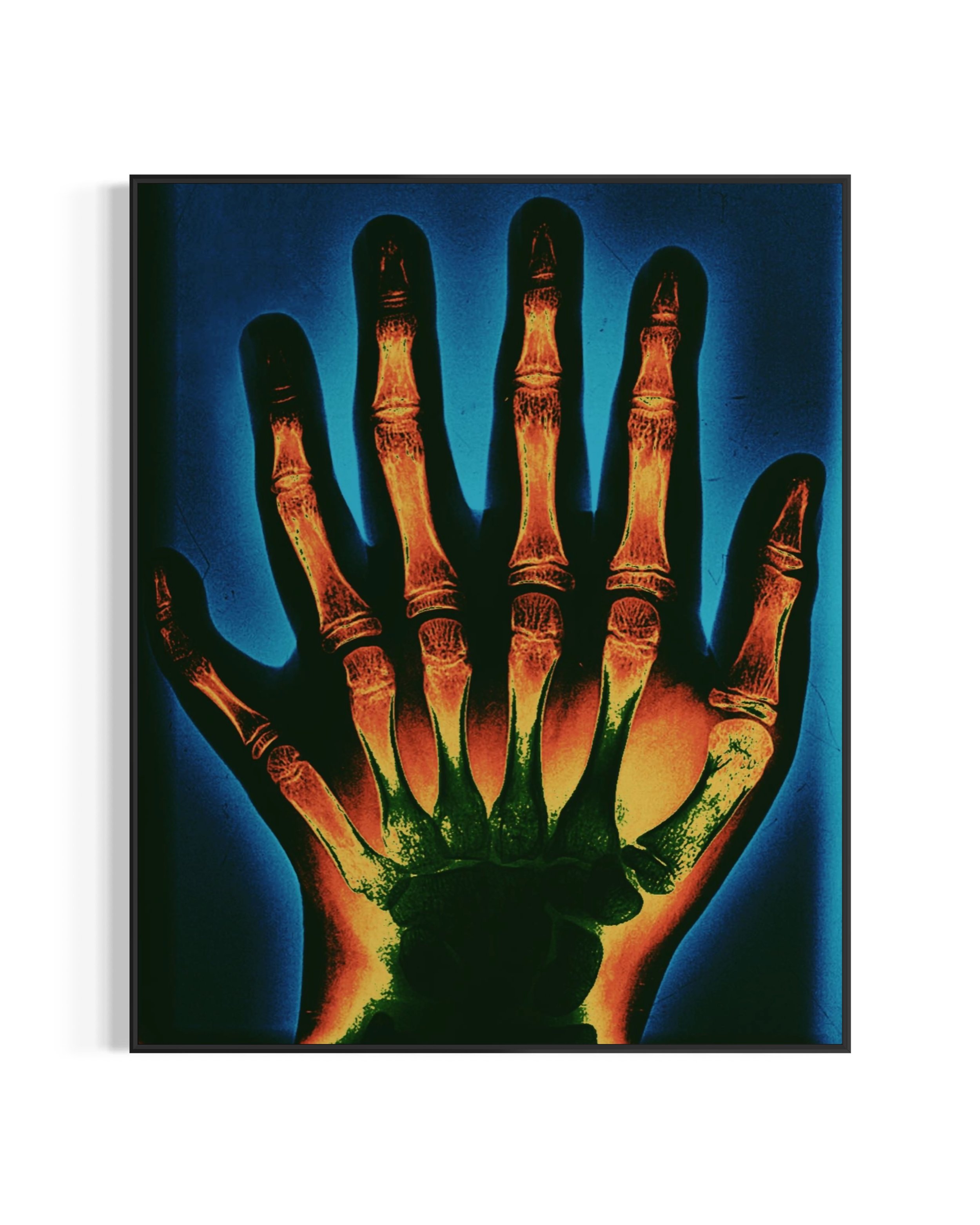 Deformity 

Dimensions: 40 in. X 30 in. X 1.5 in.

Medium: Giclee Photo Print on Canvas with White Floating Frame

#printmaking #prints #art #portlandartist