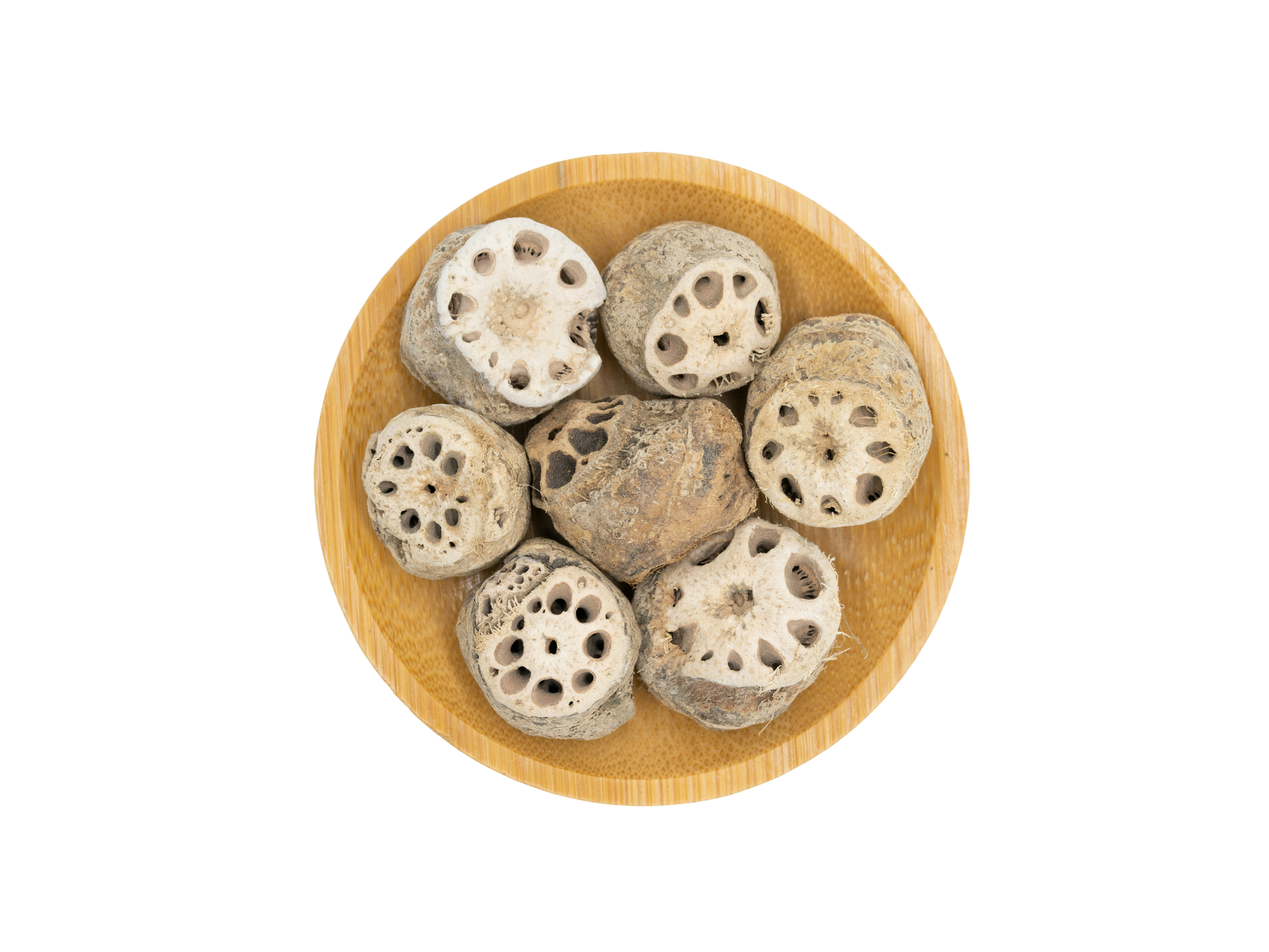 Acupuncture for Endometriosis
