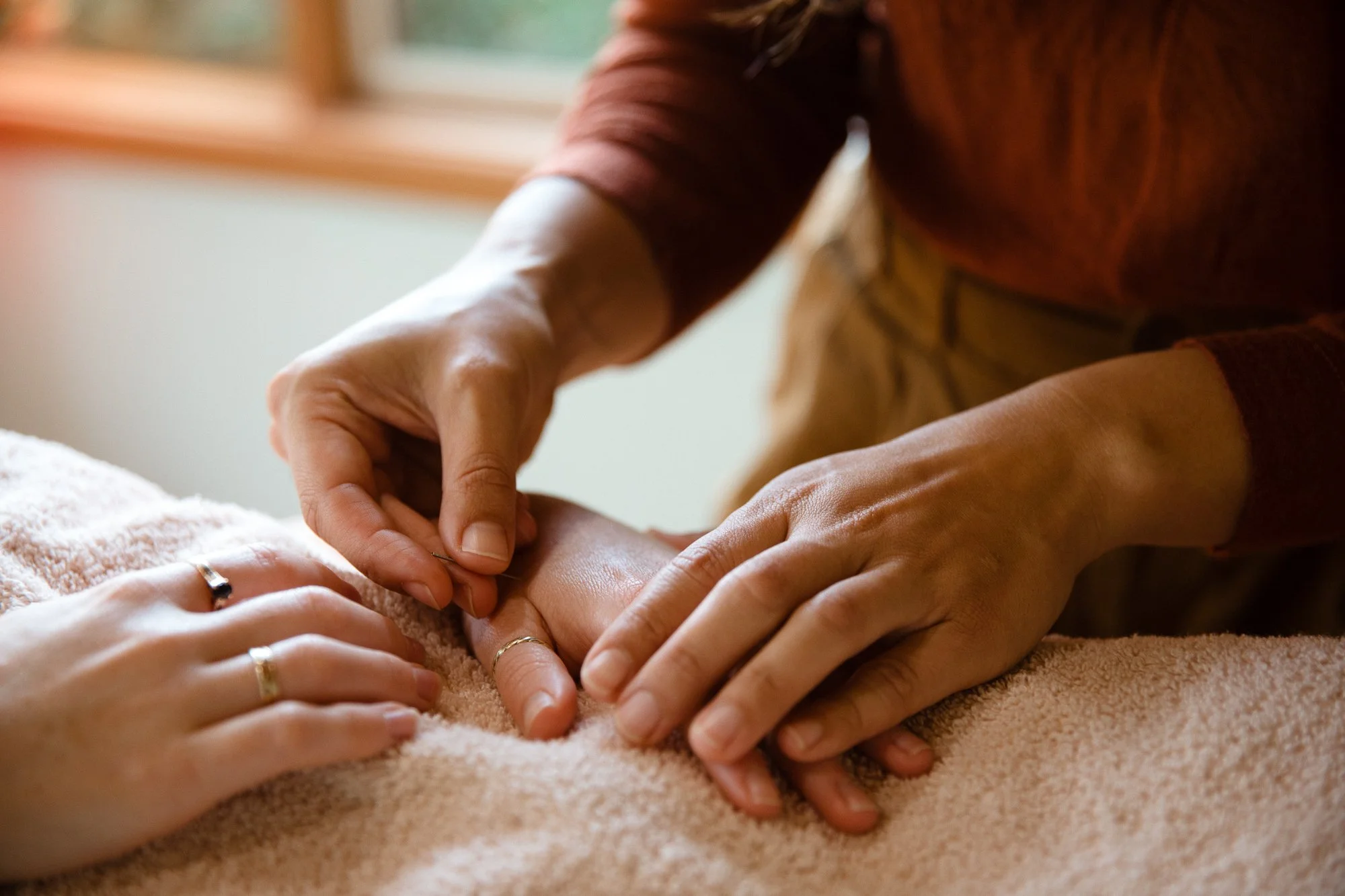 Acupuncture