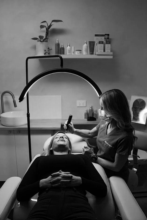 Skin Needling