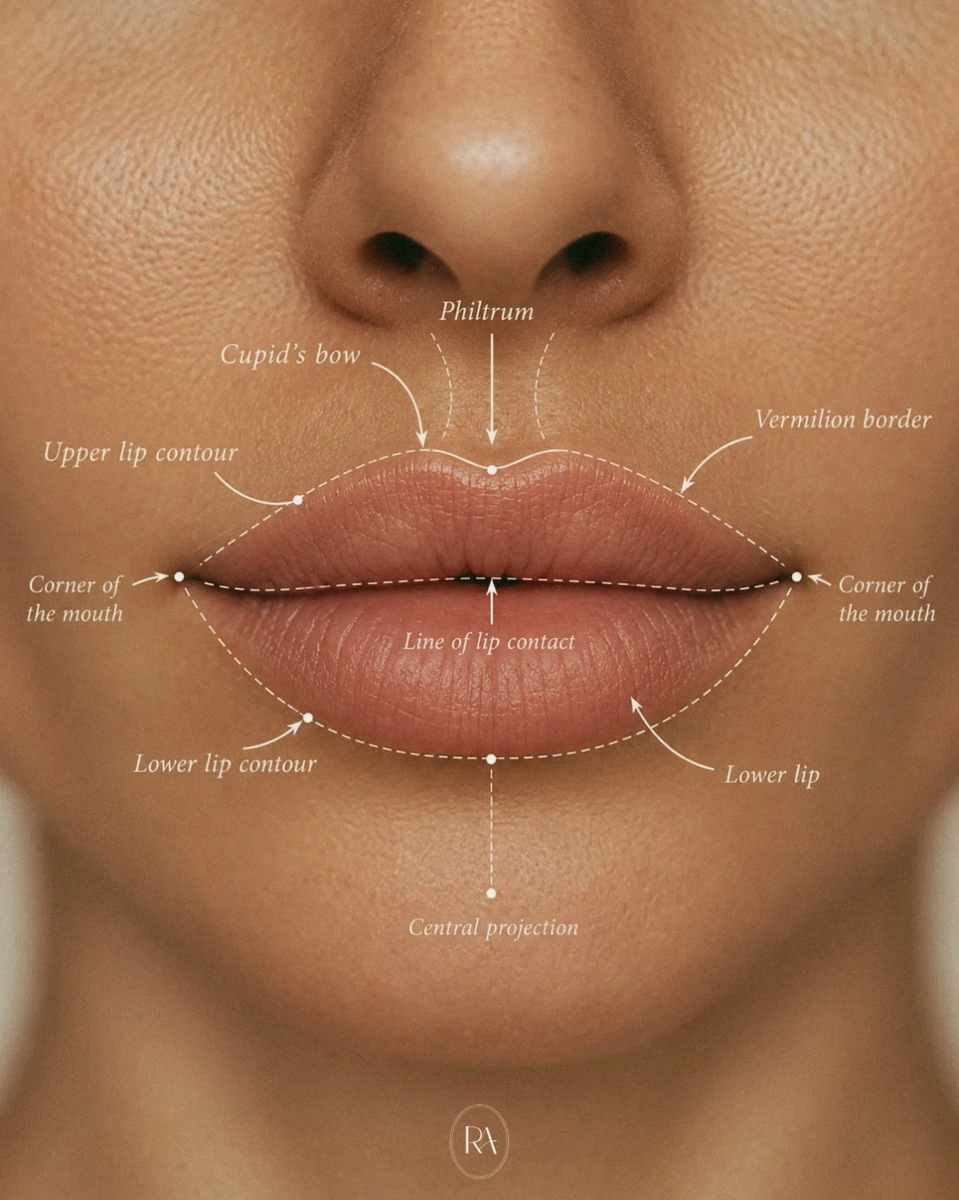 The anatomy of the lips 👄

Our lips are made up of several unique features, each contributing to their natural shape, definition and movement.

From the Cupid&rsquo;s bow and vermilion border to the delicate sensory nerve endings that make our lips 