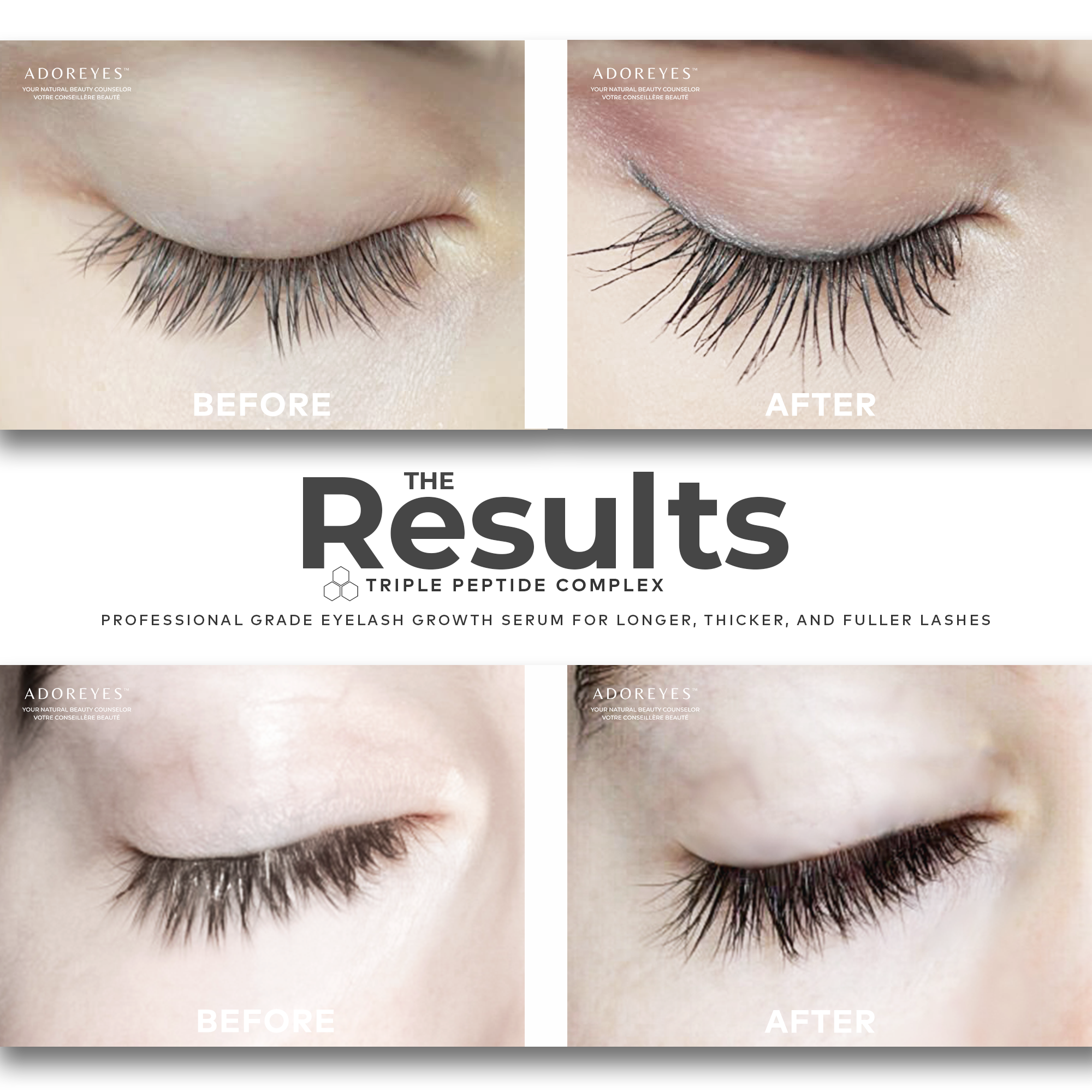 ADOREYES_Before_After_Ads copy.png