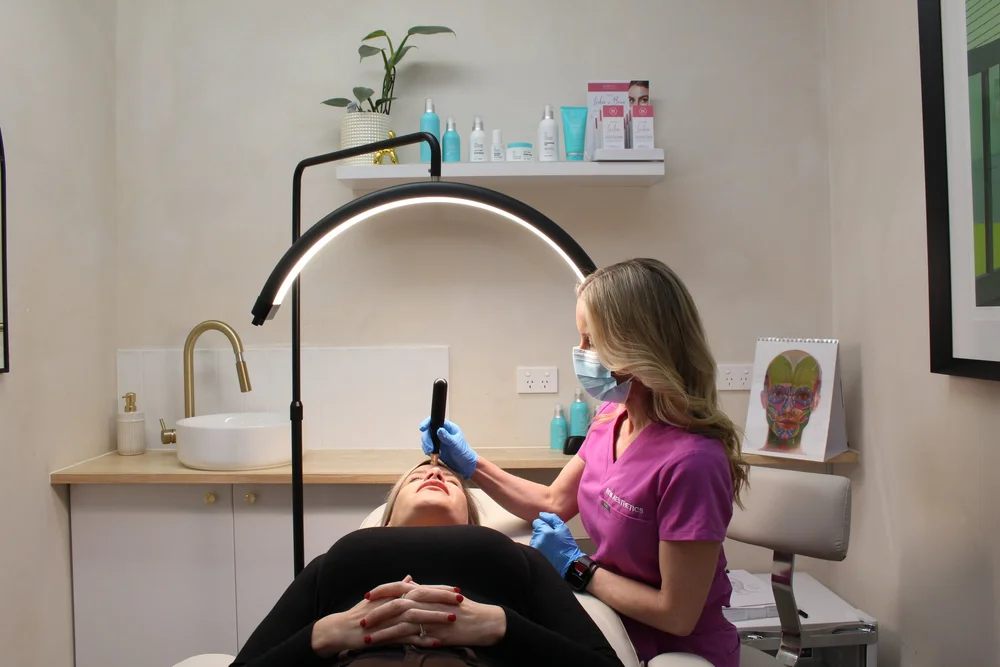 Skin Needling