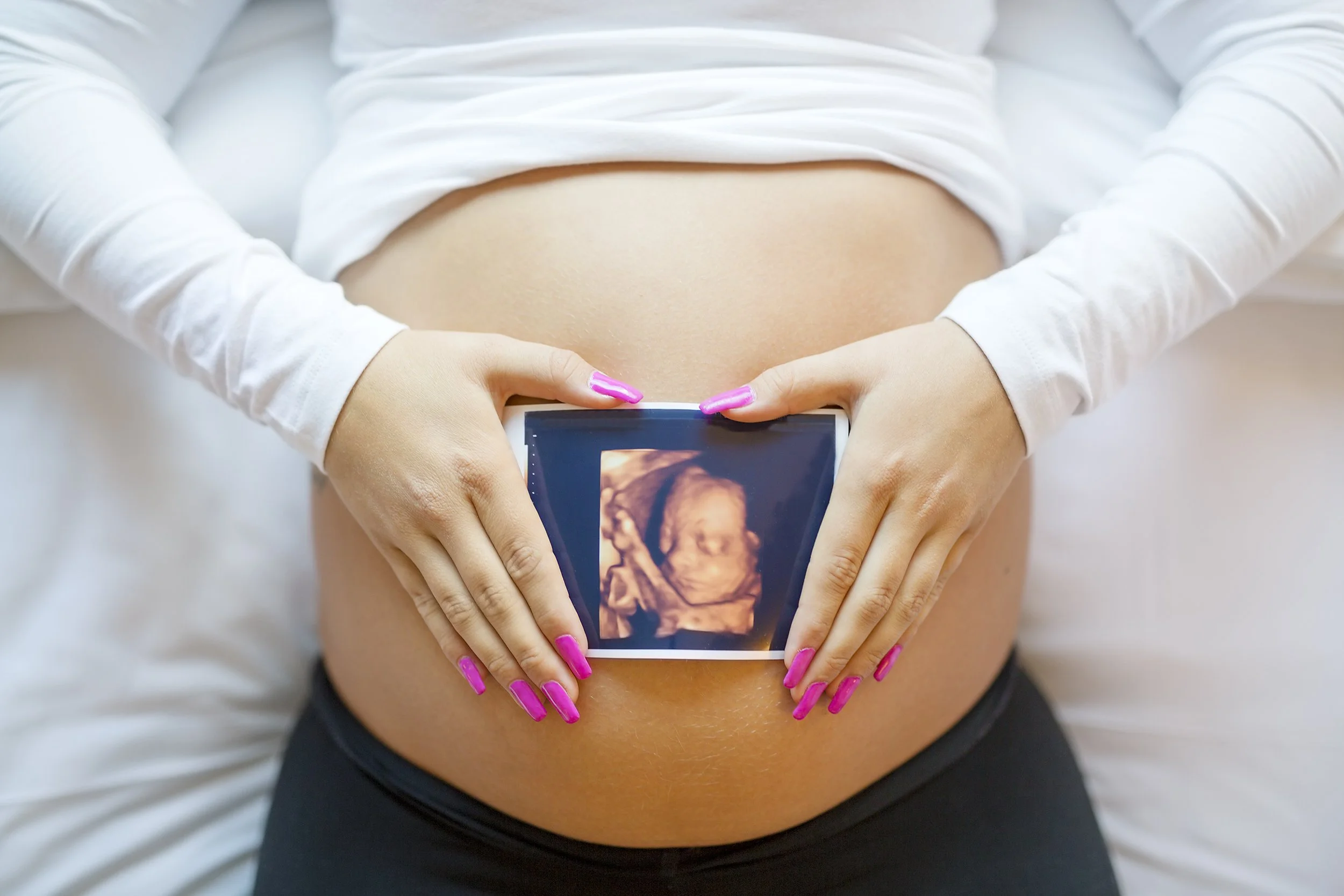 Concierge OB Imaging: Creating Memories Through 2D, 3D, and 4D Ultrasound