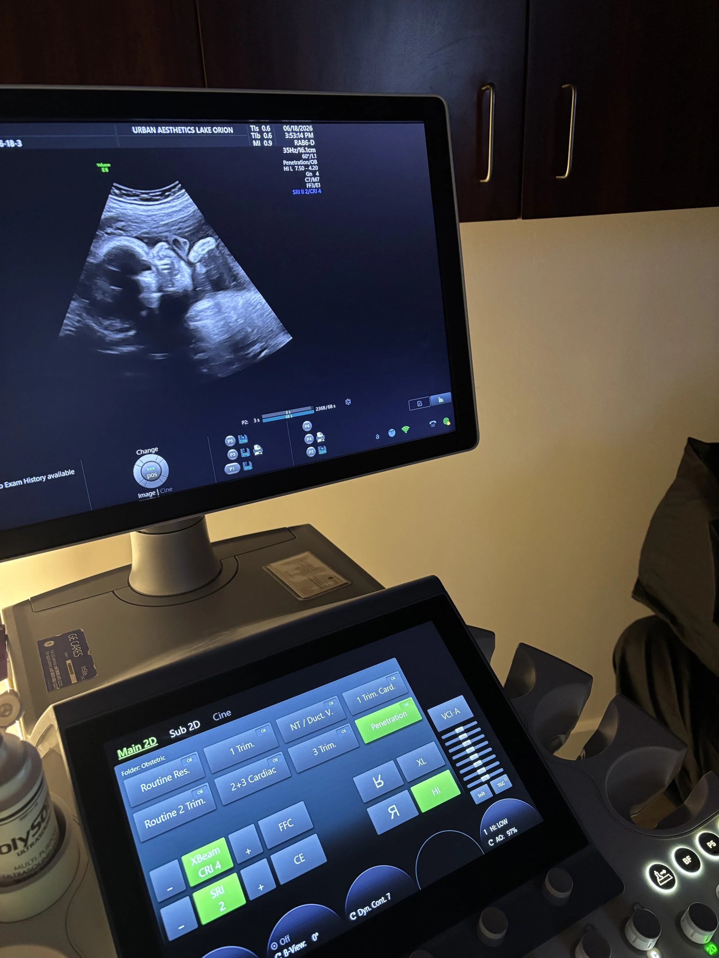 Elective 3D 4D baby ultrasound concierge OB imaging Michigan