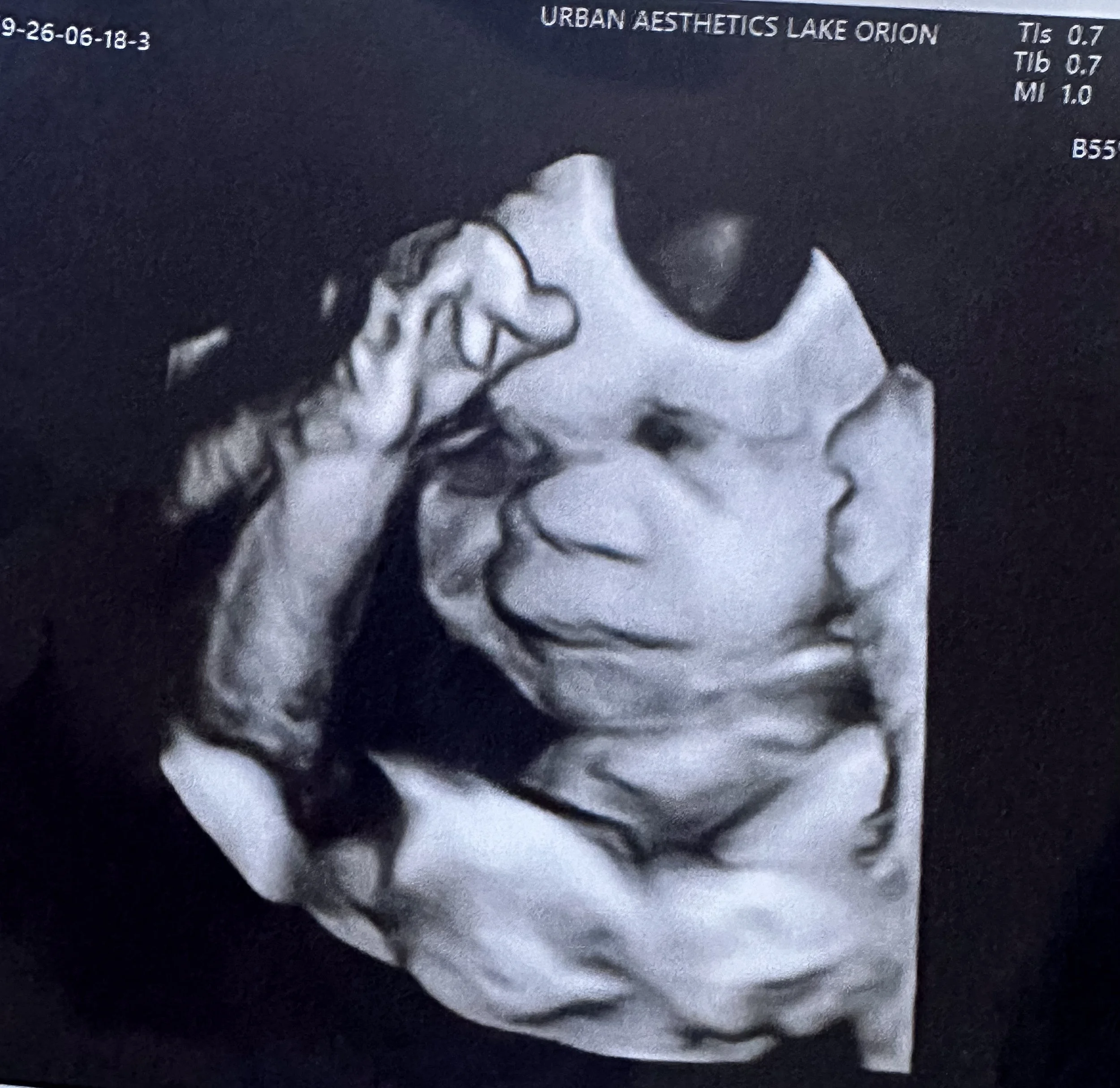 Elective 3D 4D OB ultrasound imaging Southeast Michigan