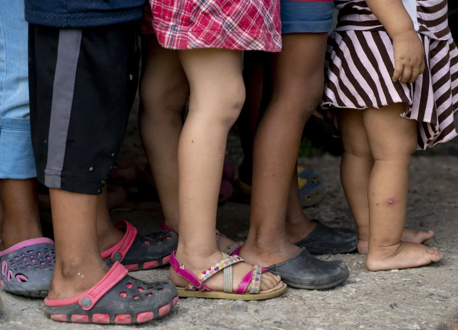 Close-up of children's legs and feet, some barefoot, standing on dirt ground, wearing various sandals and shoes, with dirt and minor bruises visible.