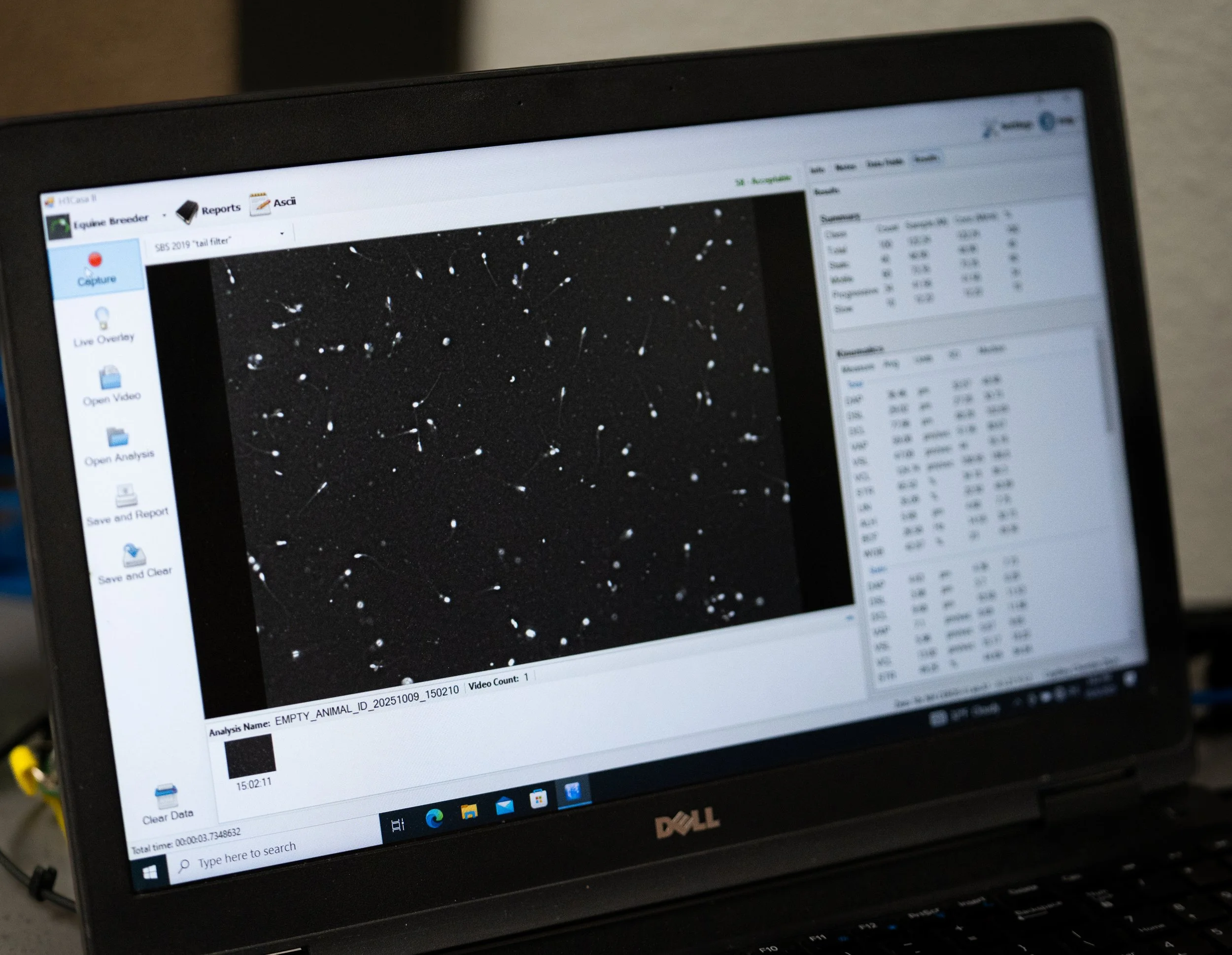 A laptop screen displaying a scientific image of neuron cells with tracked connections, alongside data tables and analysis options from a neuroscience software program.