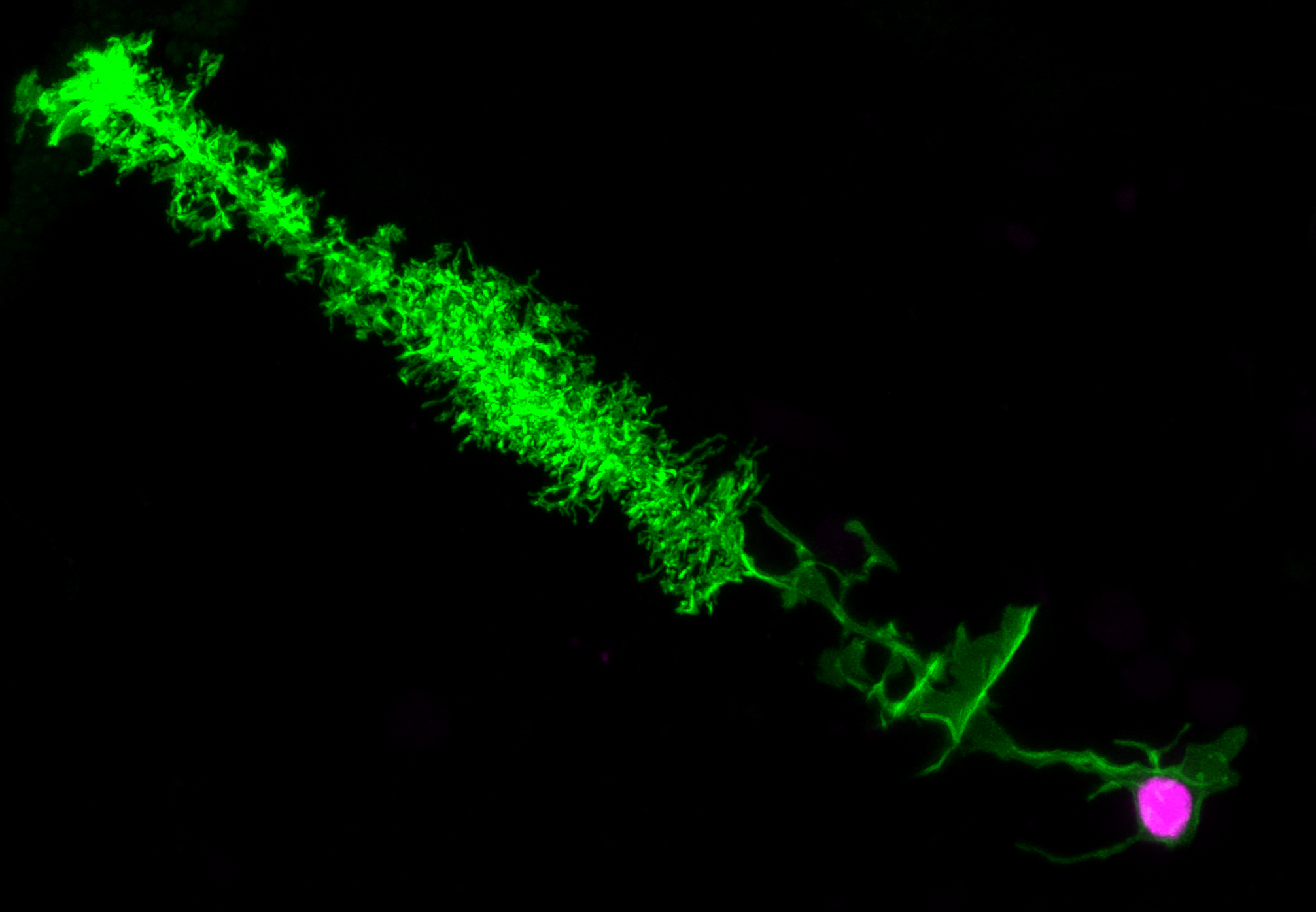 Microscopic view of fluorescently labeled neurons or nerve cells with green and purple fluorescent signals.