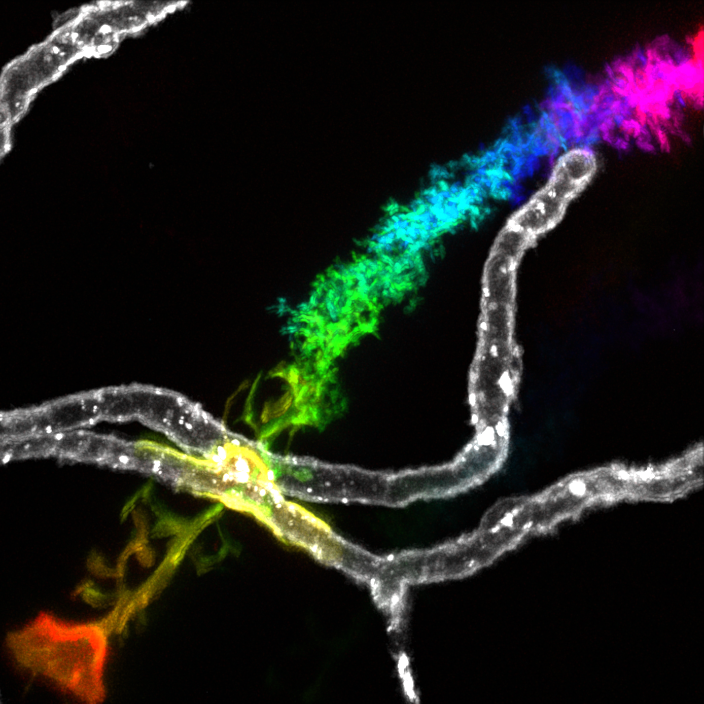 Colored fluorescent bacteria with white filamentous structures on a black background.
