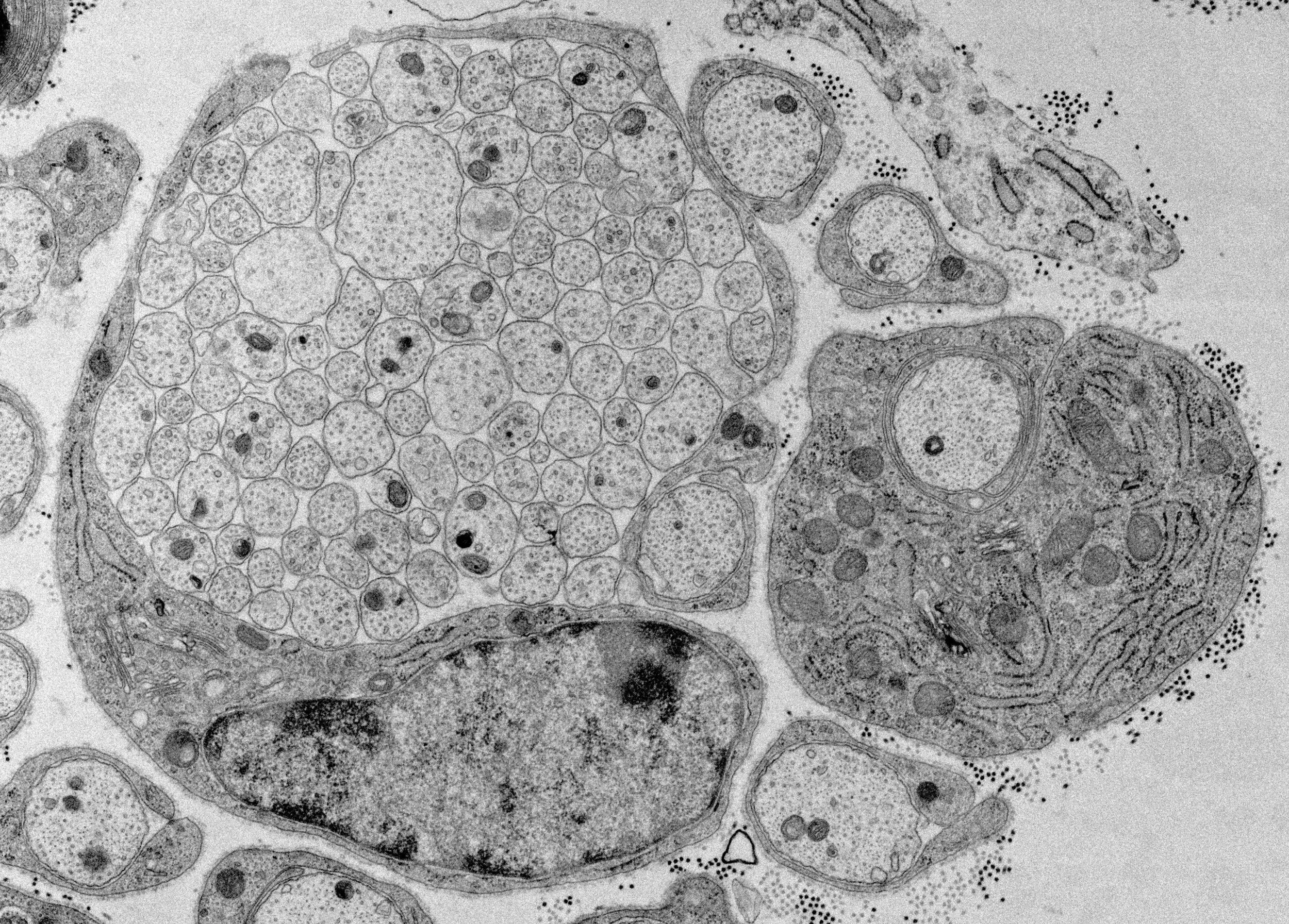 Electron microscope image showing detailed cellular structures, including various organelles and intricate cell components, in grayscale.
