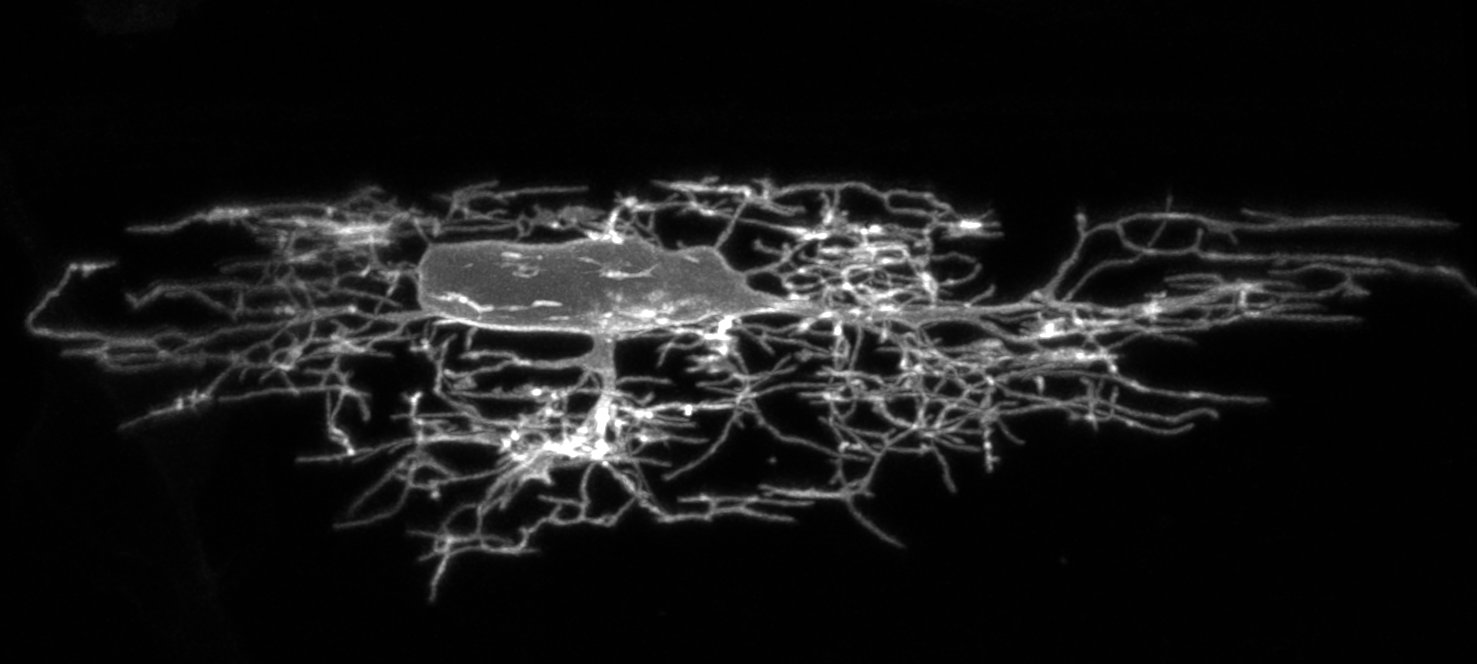 Close-up of a biological sample under a microscope, showing a circular structure with radiating filament-like extensions.