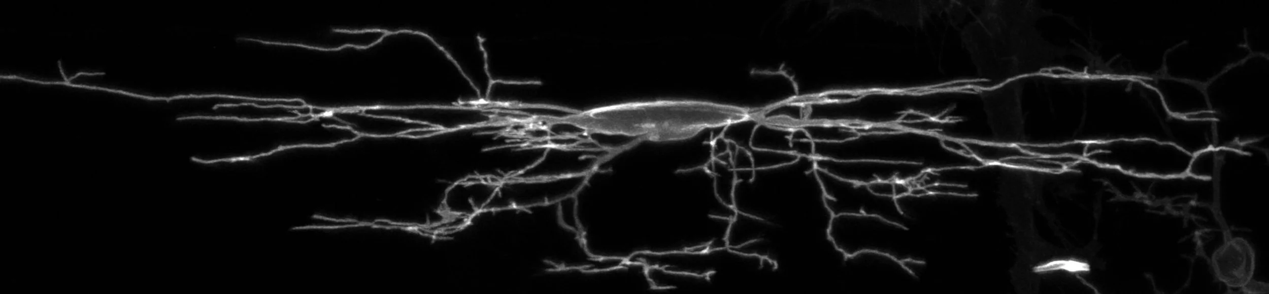 Single oligodendrocyte precursor cell in black background and gray shading