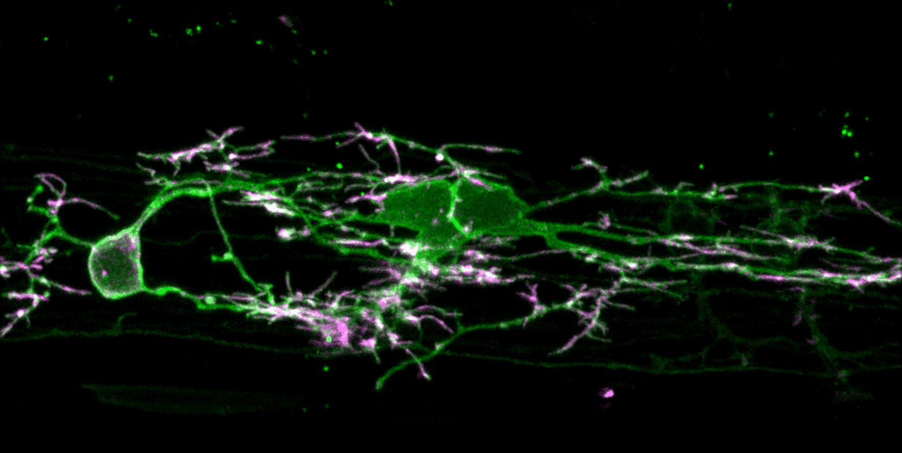 Microscopic image of neural connections with green and purple fluorescent labels.