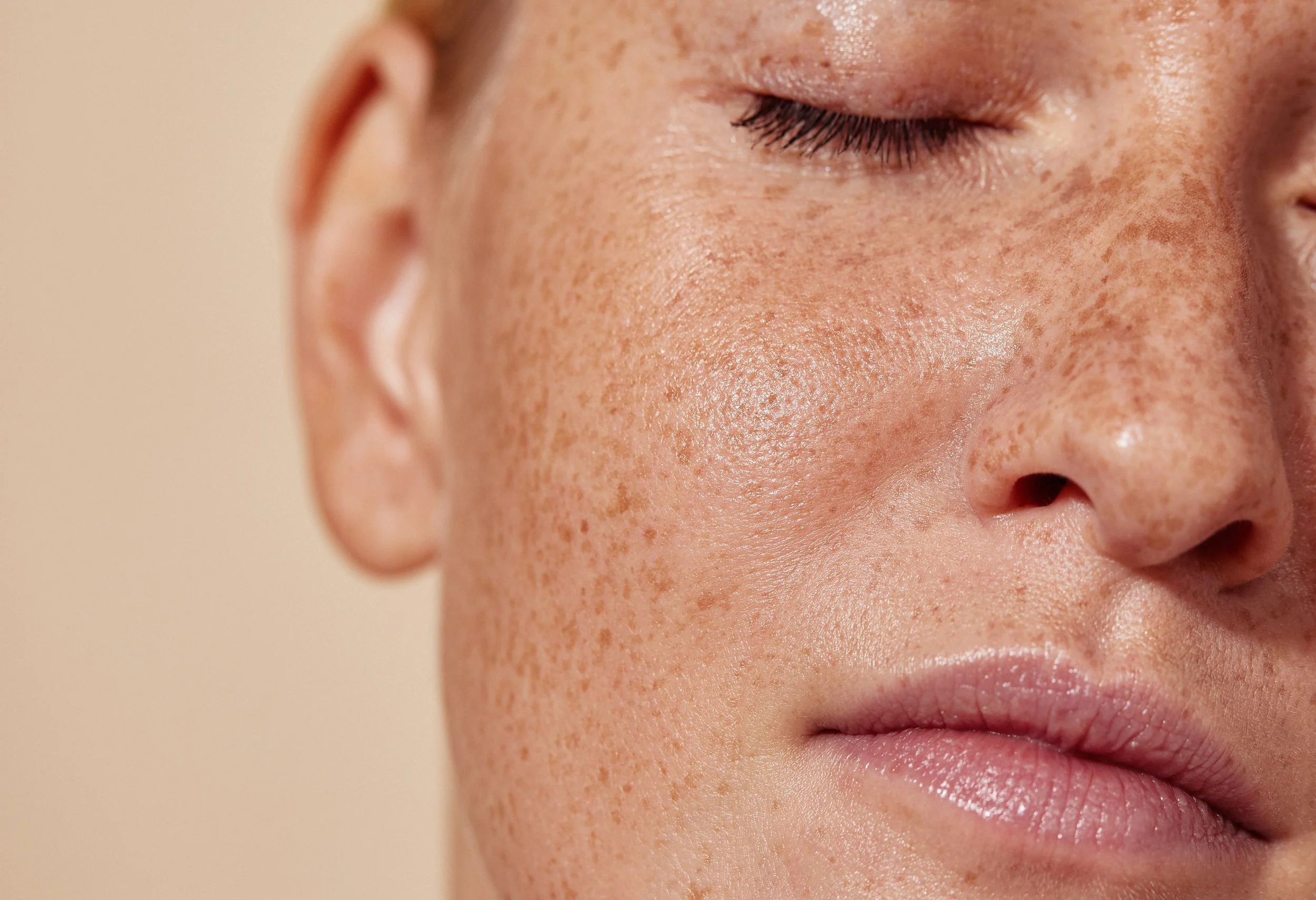 Smooth and healthy aging skin. Face with closed eyes, showing freckles and smooth skin.