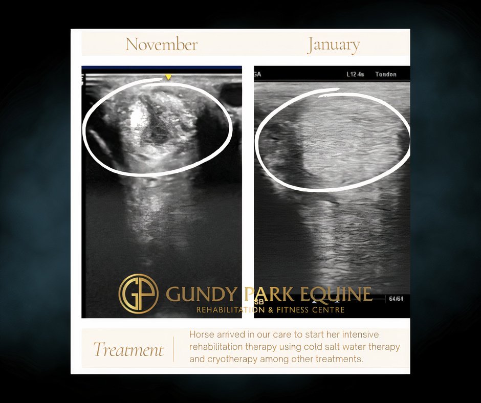 An equine SDFT injury was successfully treated using cryotherapy and hydrotherapy.