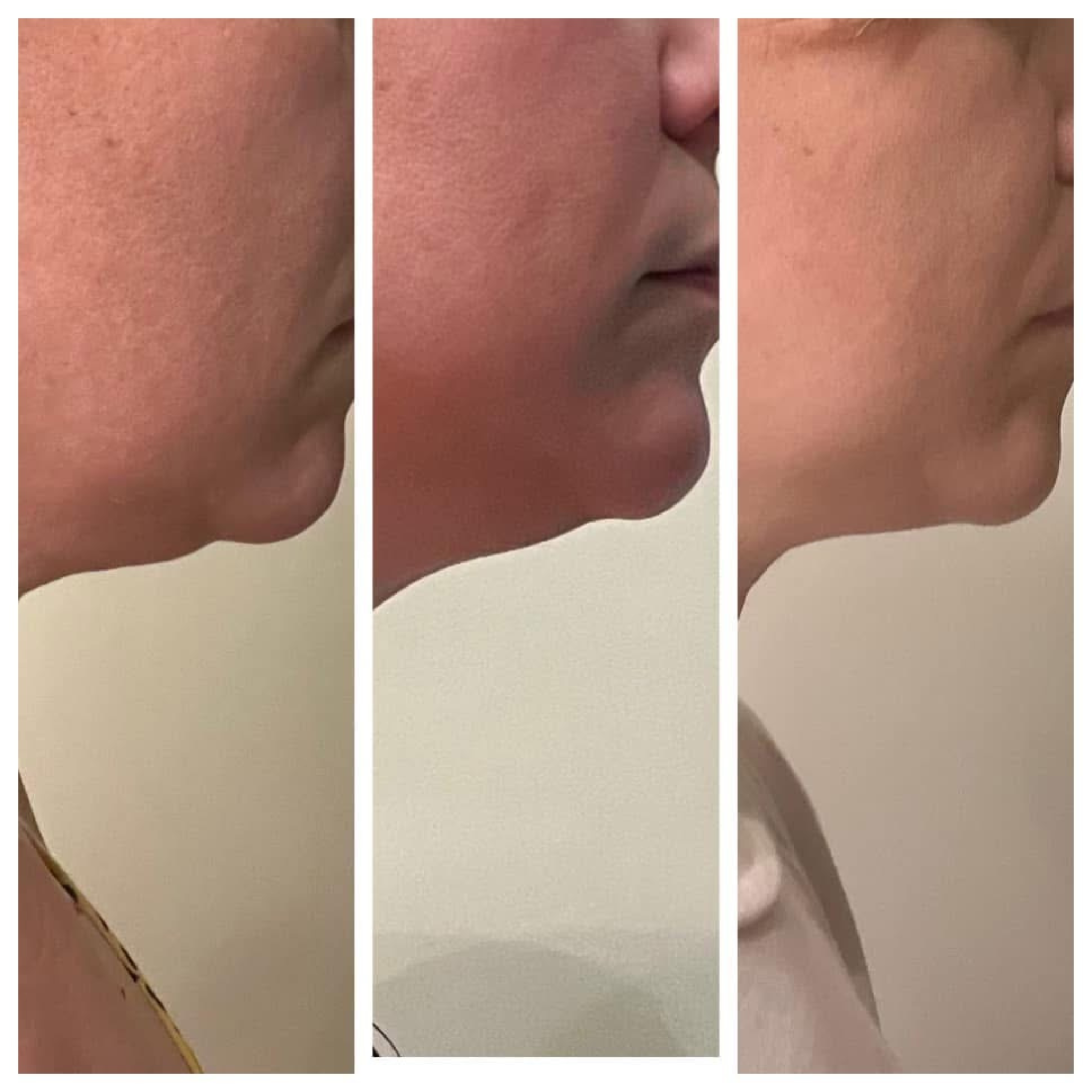 A collage of three close-up images showing the side profile of a person's face at different stages, focusing on skin texture and facial features.