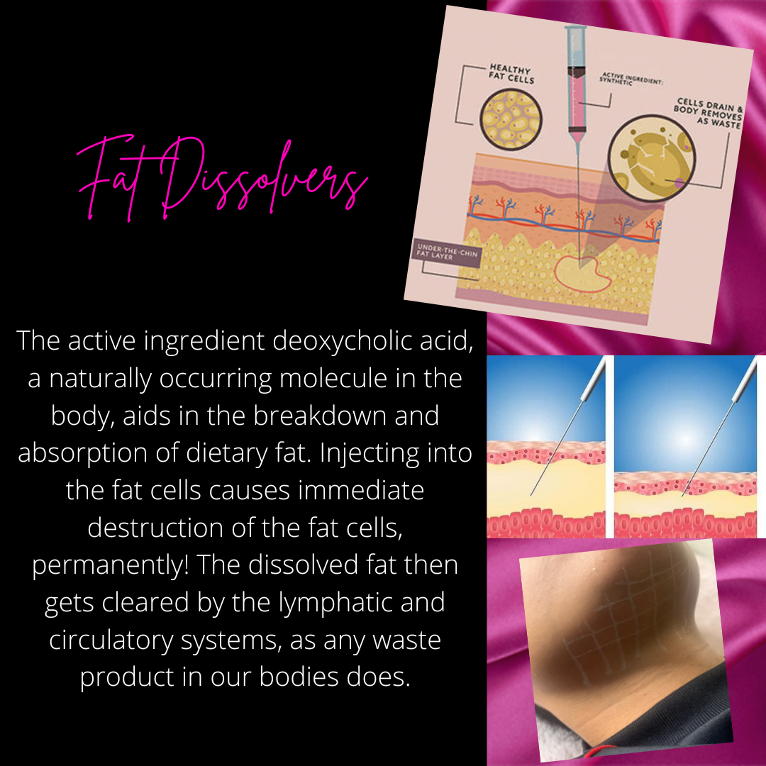 Diagram showing fat dissociation process, including injection into fat cells and removal of waste via lymphatic system; example of a body area with a grid pattern indicating treatment.