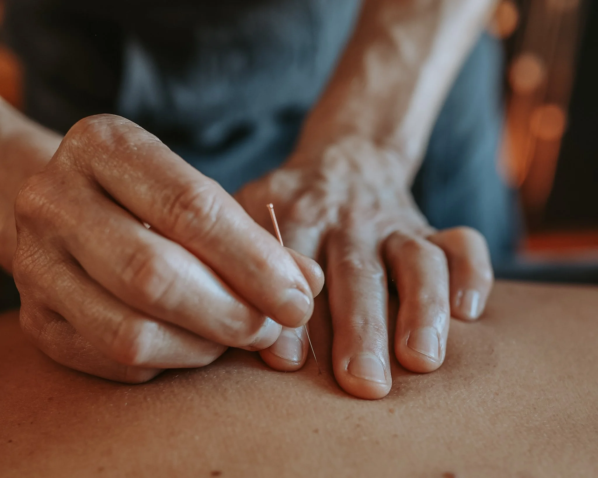 Gina is dry needling a patients back while they're laying down on the massage table.