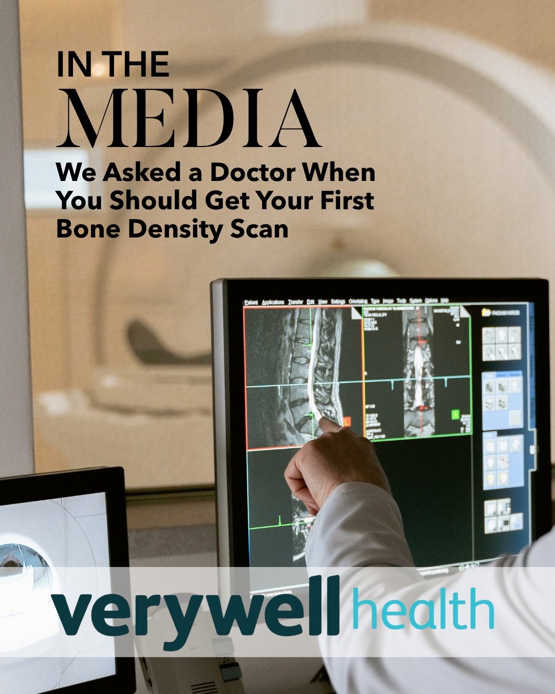 Waiting until 65 to think about your bone density may mean waiting too long.⁠
⁠
Current screening recommendations start later than I&rsquo;d like, and by then many people may have already lost a significant amount of bone. ⁠
⁠
Knowing your risk facto