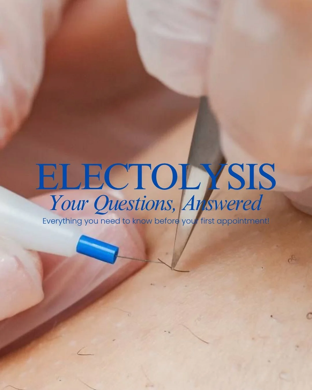 Curious about electrolysis? Swipe through to find answers to your questions and learn more about this treatment.

Interested in getting started? Book your consultation and patch test today via the link in our bio. 💌