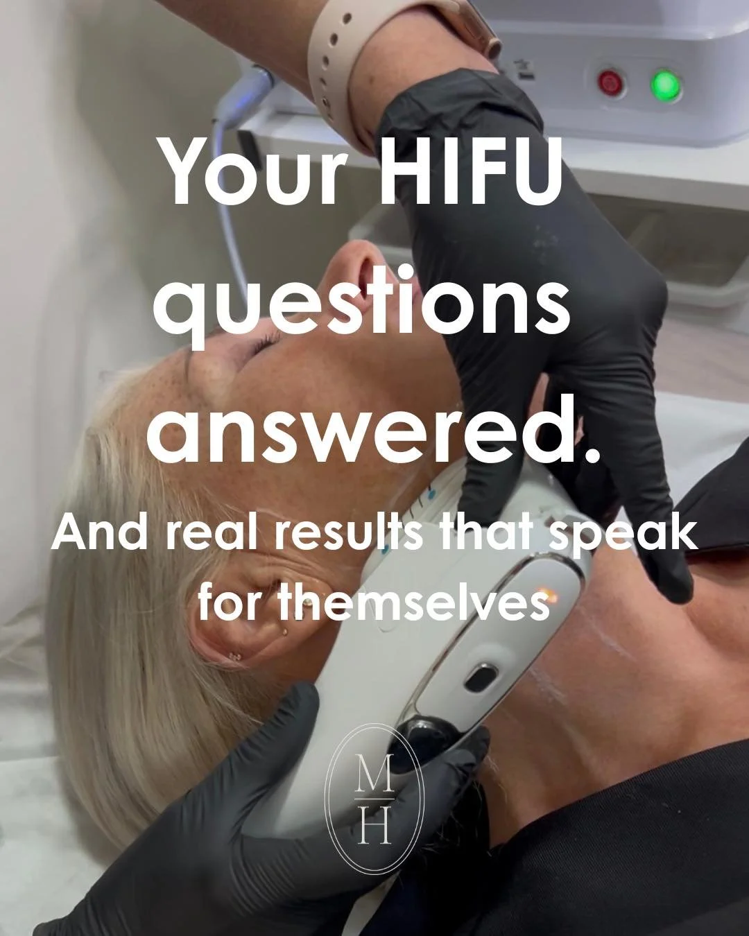 Still have questions about HIFU? We've got answers &mdash; and results. ✨

Since sharing our HIFU series we've been overwhelmed by your questions and messages &mdash; and we are so grateful for every single one. So we wanted to bring it all together 