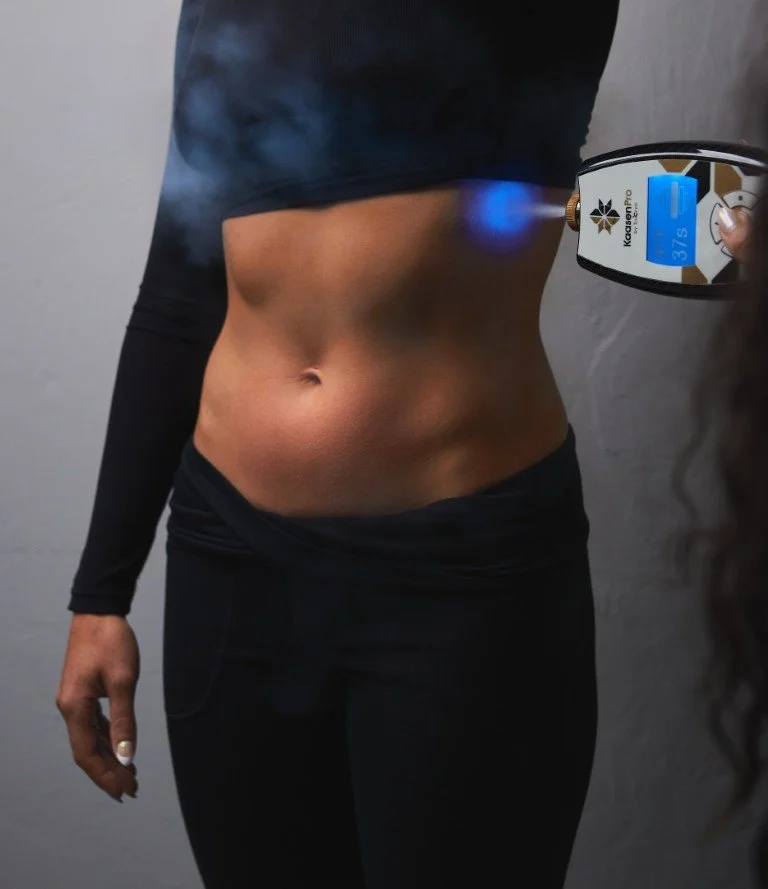 Person's midsection being treated with a laser device, possibly for fat reduction or skin tightening.