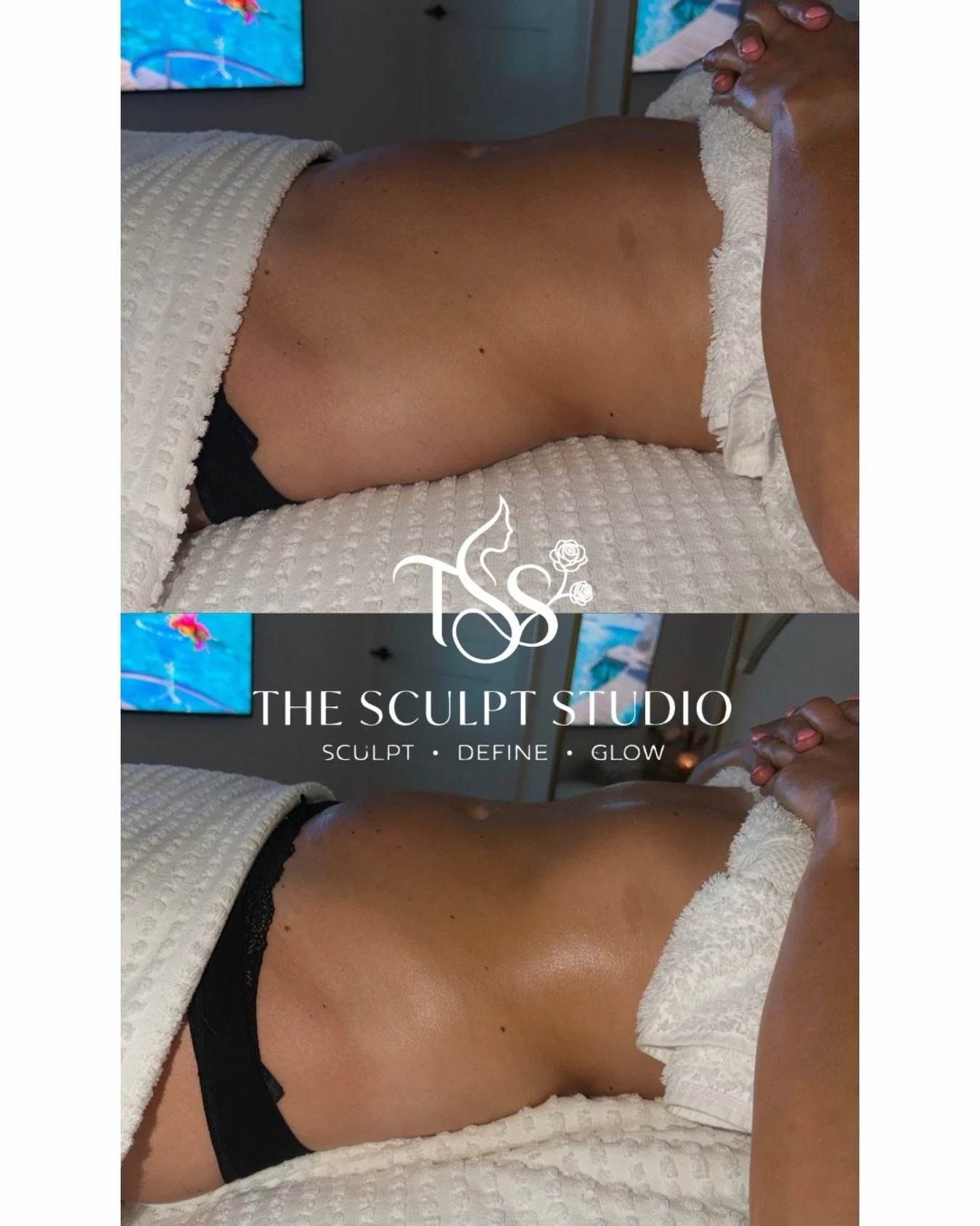 Can you see the difference? 👀✨

A flatter, smoother and more defined appearance following Brazilian lymphatic drainage &mdash; helping to reduce bloating and fluid retention while naturally sculpting the waist and tummy.

No downtime, just a relaxin