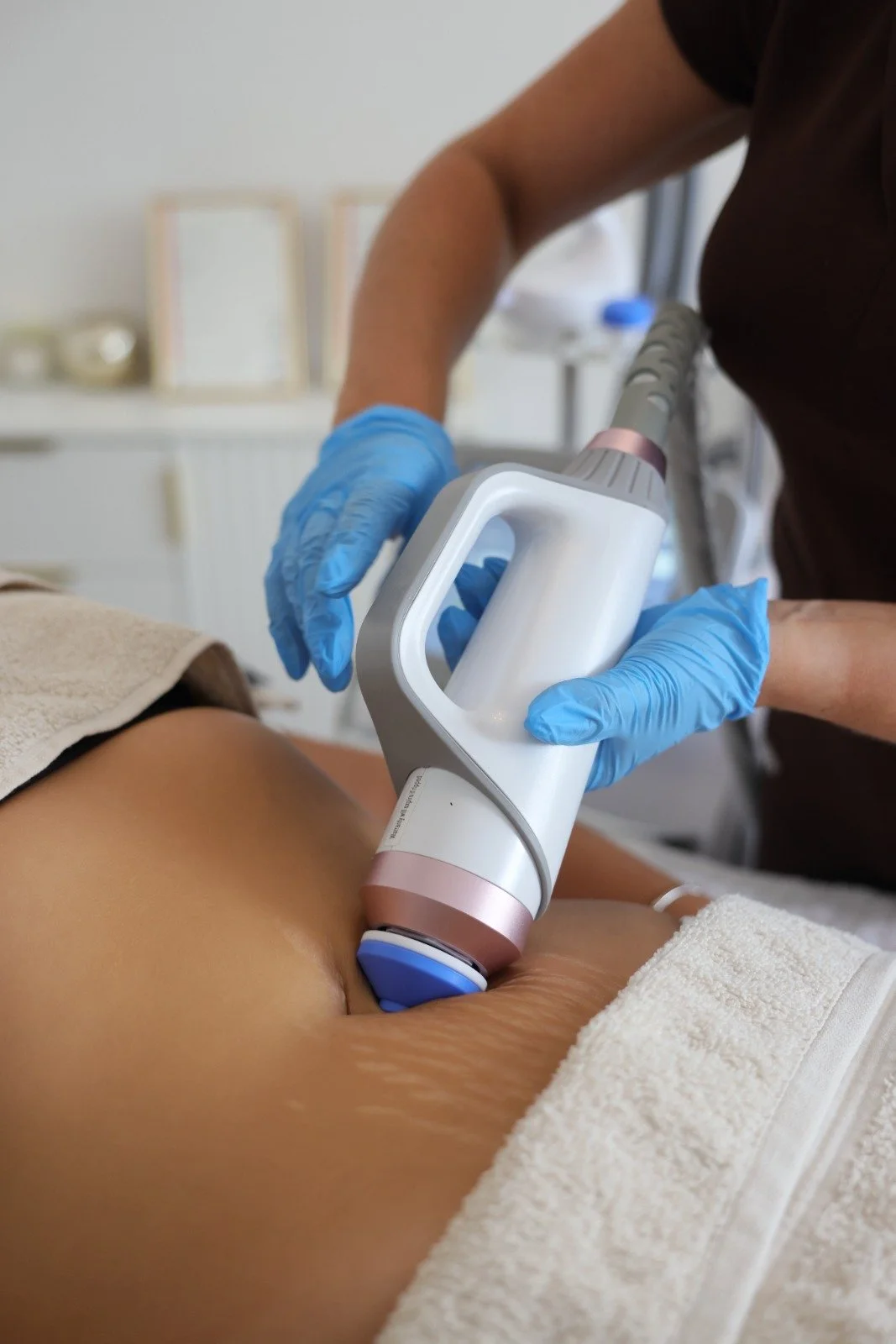 Non-surgical stomach sculpting body contouring treatment