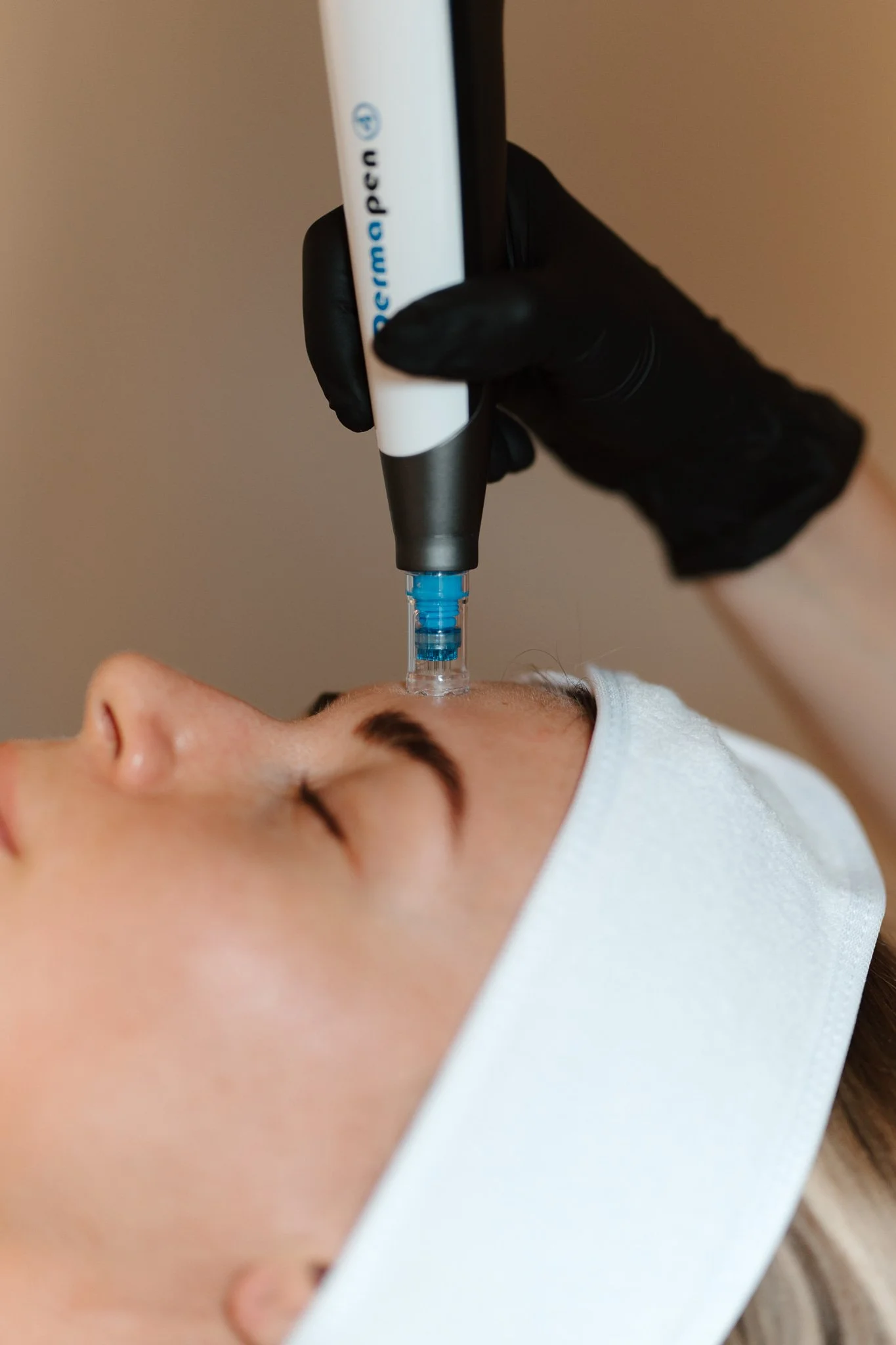 A person receiving a cosmetic injection or treatment on their forehead, with a healthcare professional wearing black gloves holding a syringe or device.