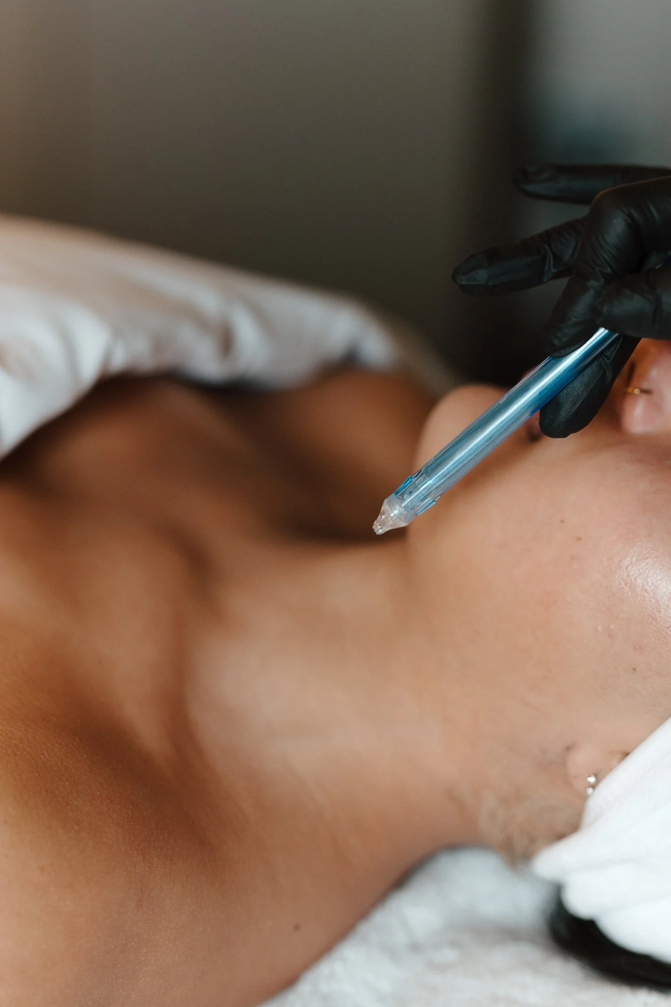 A close-up image of a person receiving a cosmetic injection in their face, with a gloved hand holding a syringe near the cheek.
