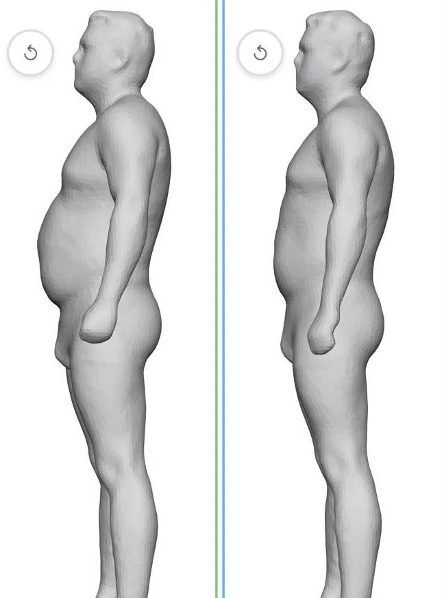 Side-by-side comparison of two 3D body models, showing differences in abdominal protrusion and posture.