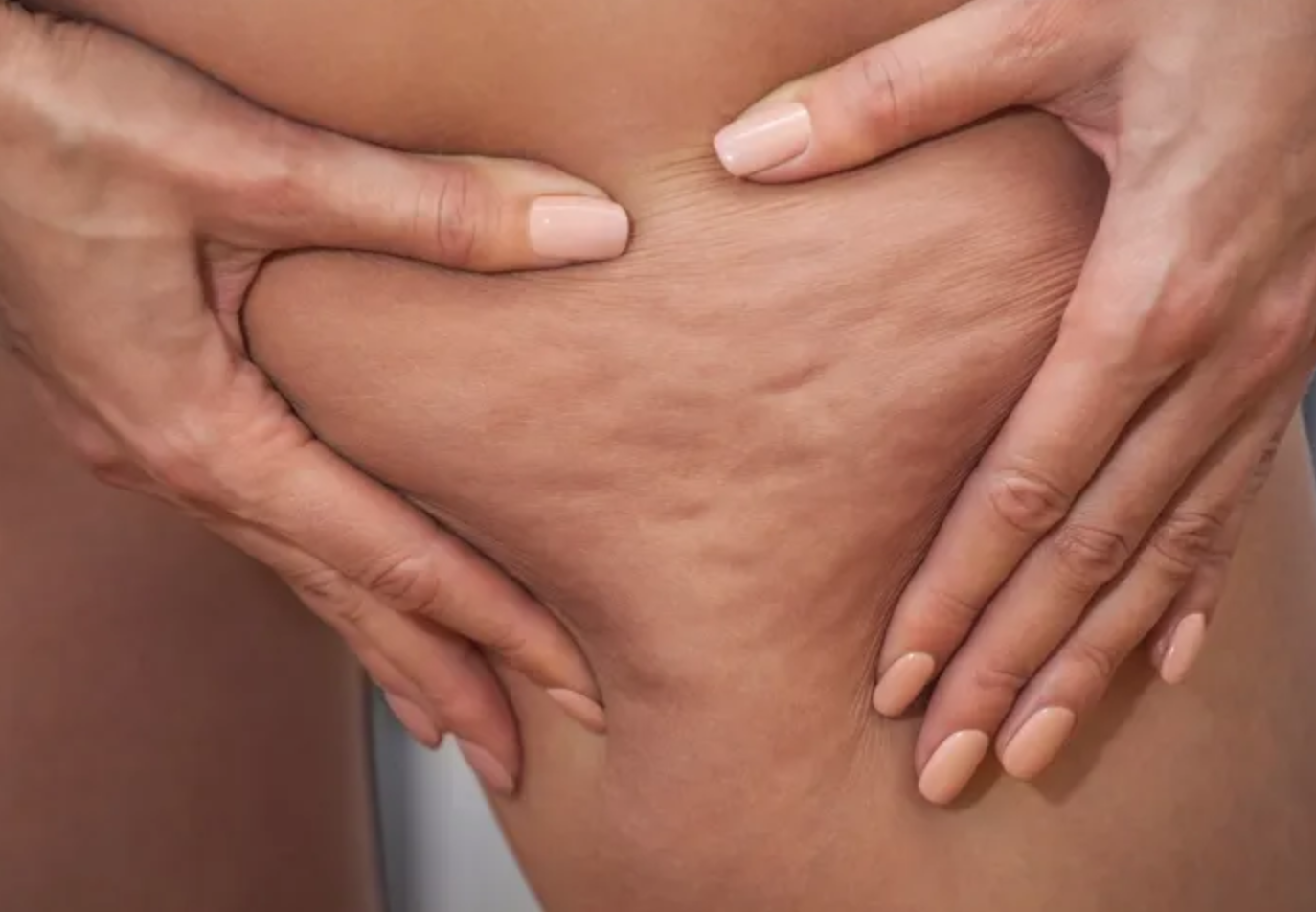 palper rouler manuel anti-cellulite matrivirat center nice