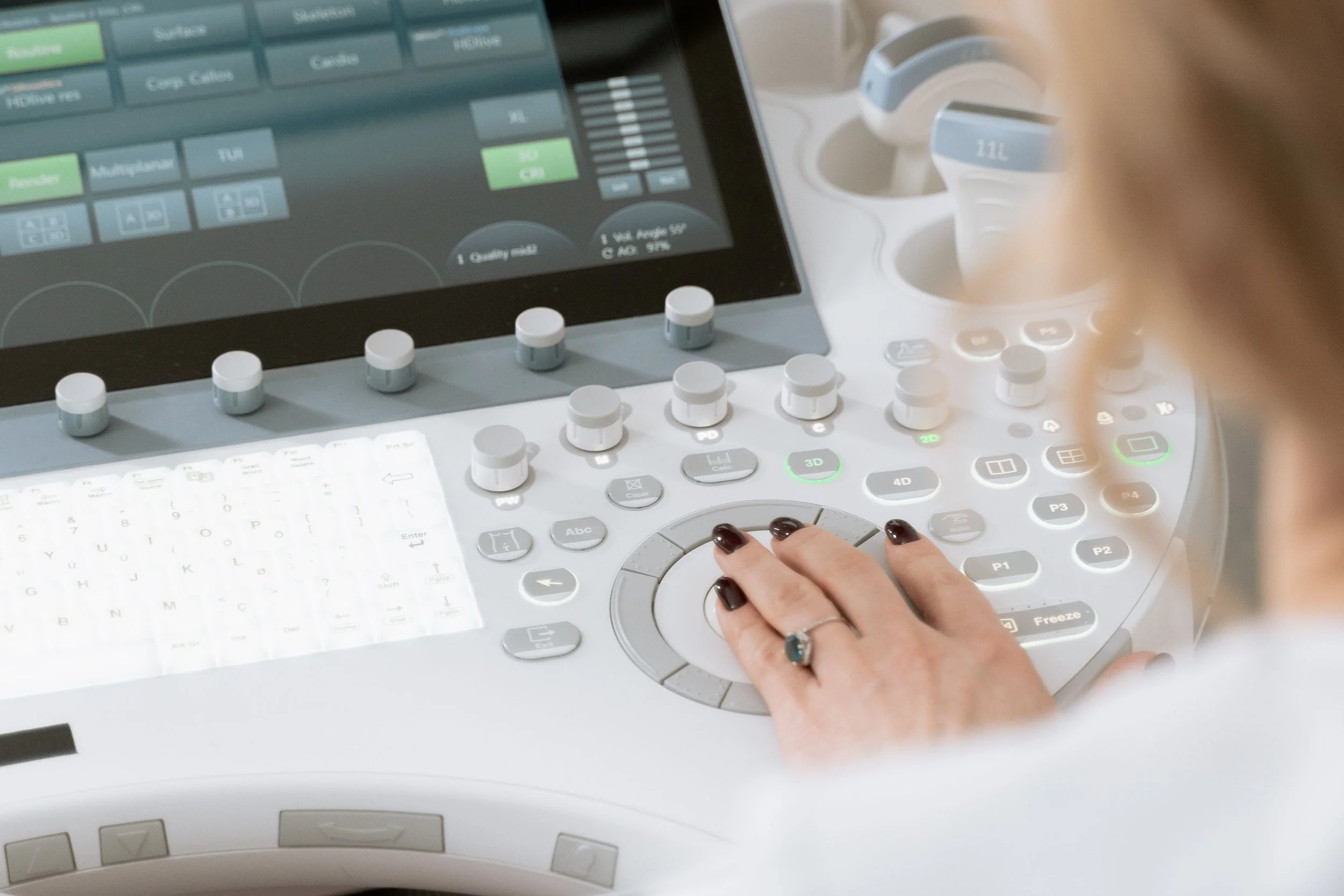 A close up image of an ultrasound machine with a woman's hand on the controls with dark painted nails.