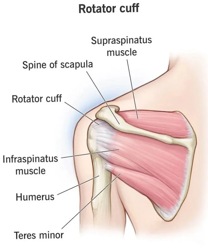 Understanding Rotator Cuff Tendinitis: Causes, Symptoms, and the Path to Recovery