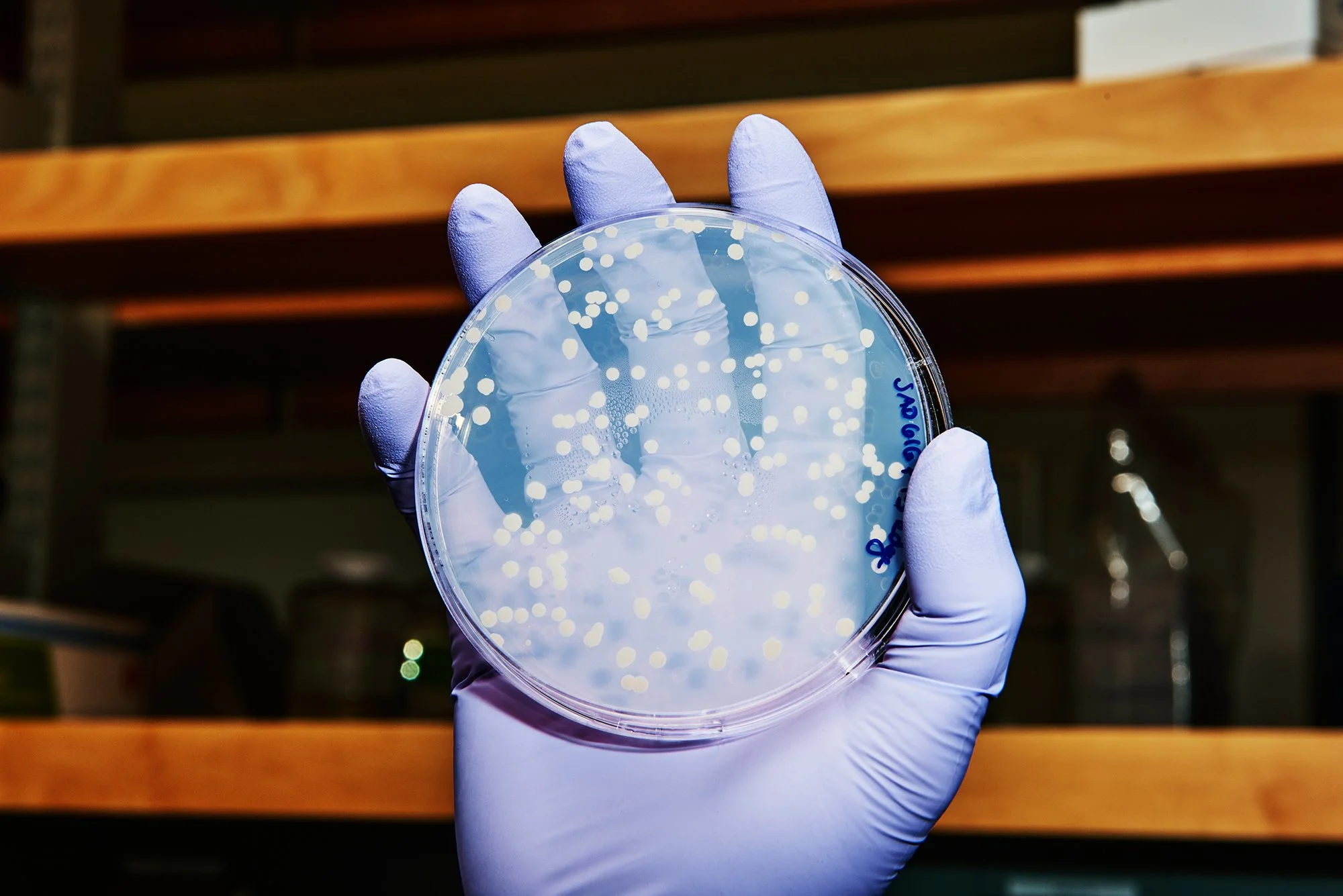 20160304-wired-adimab-0842.jpg