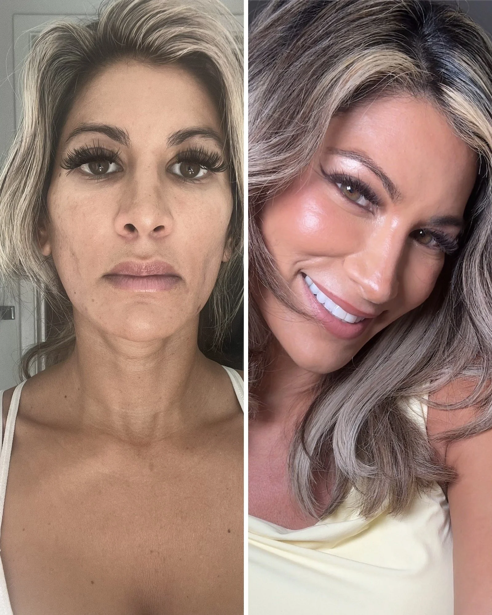 The Honest Facelift Guide