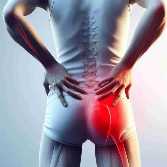 Síndrome del Nervio Ciático y cómo el Masaje Terapéutico puede ayudar en tu Recuperación