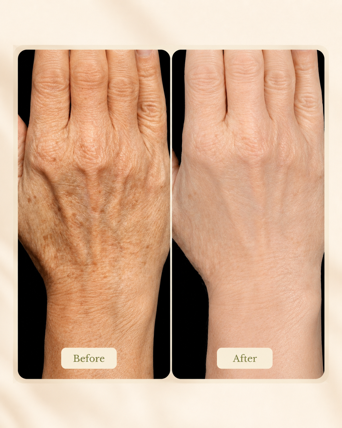 Side-by-side comparison of a hand before and after skincare treatment showing improved skin texture, reduced wrinkles, and a smoother appearance.