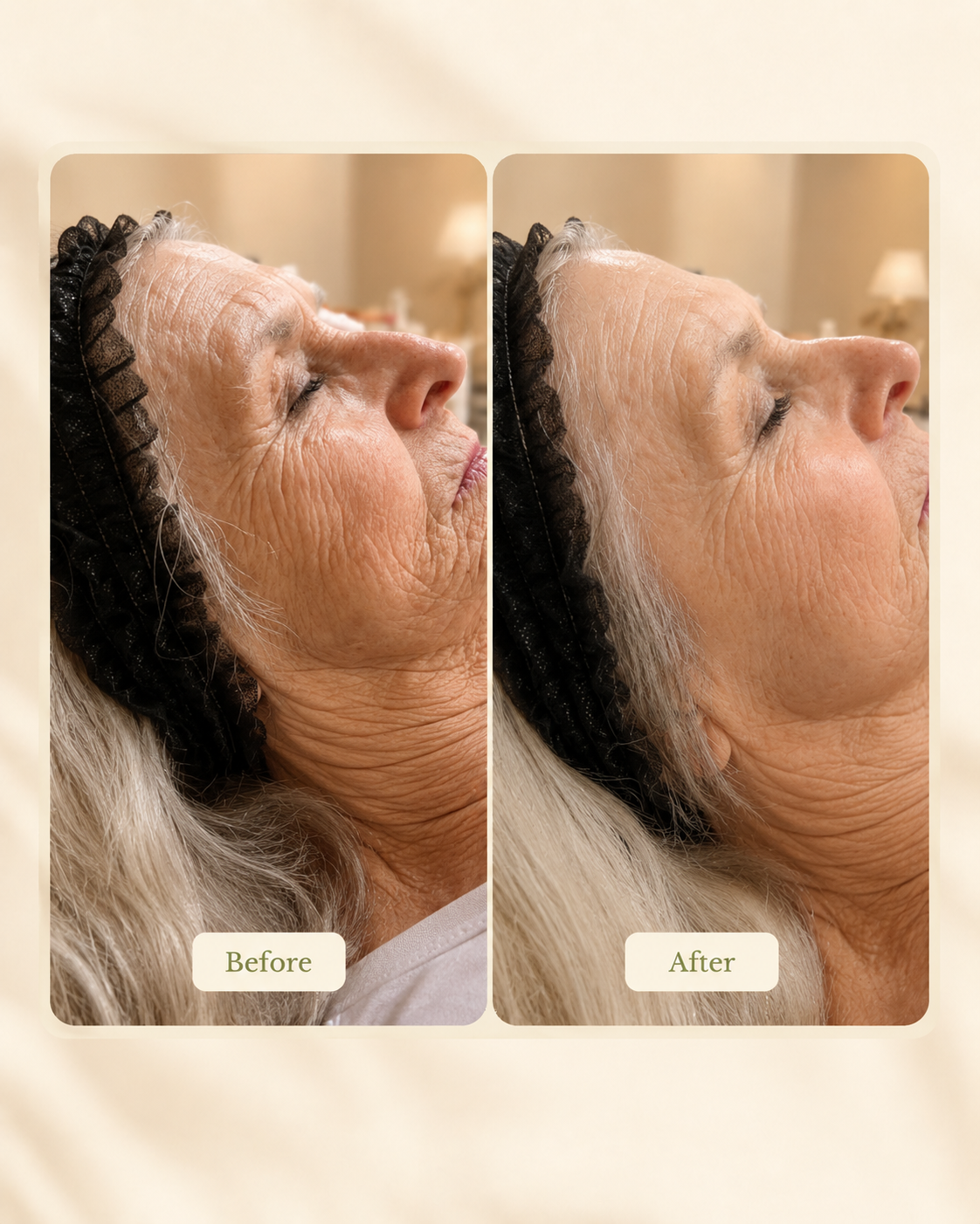 Before-and-after skin treatment comparison for mature skin at Skin Intrinsic.