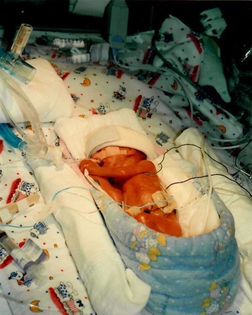 Newborn baby in an incubator in a Neonatal Intensive Care Unit, surrounded by medical equipment and blankets.